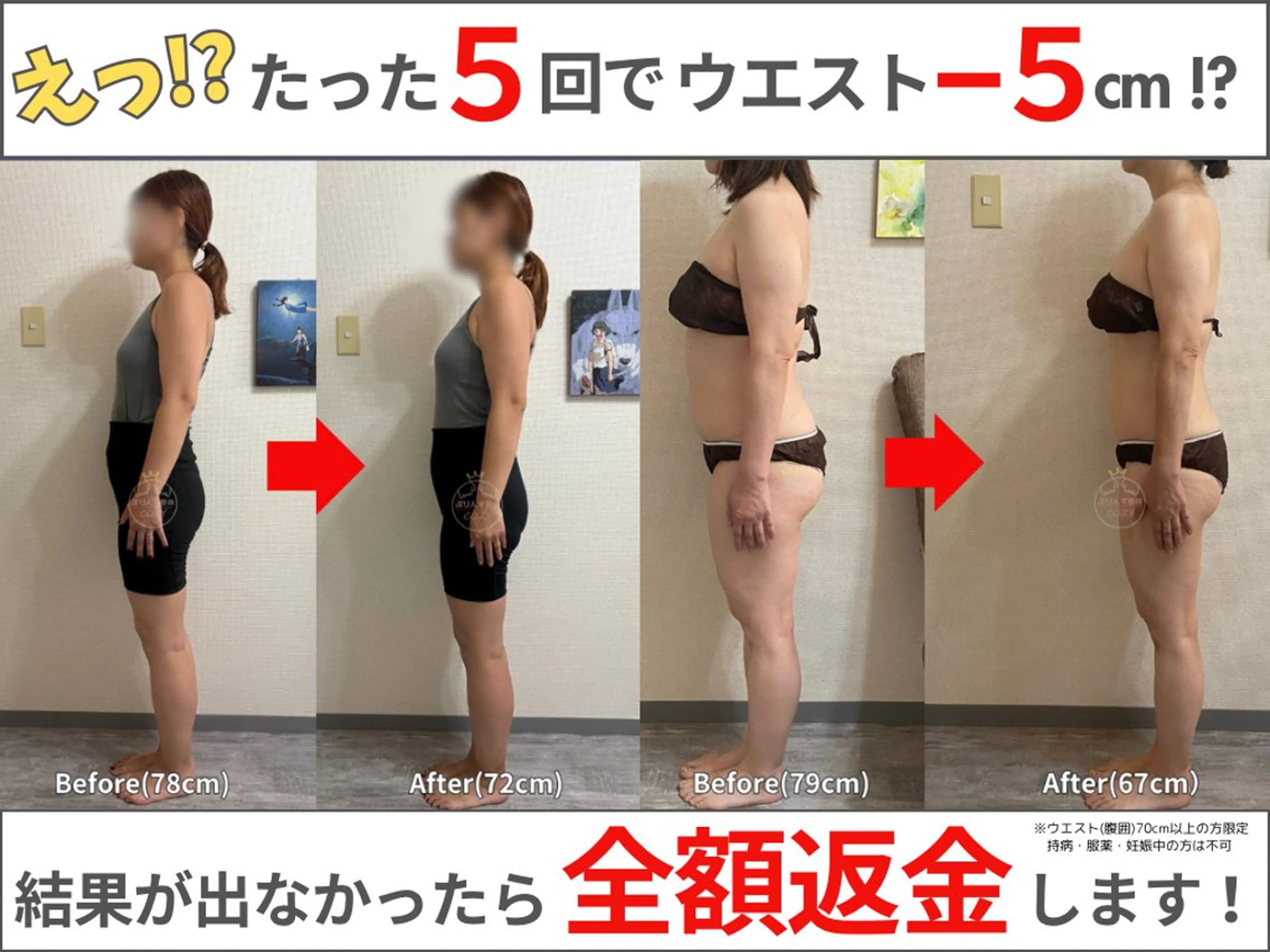 エステ リラク 骨盤矯正ダイエット ぷりんす整体COZYのエステ・リラクイメージ