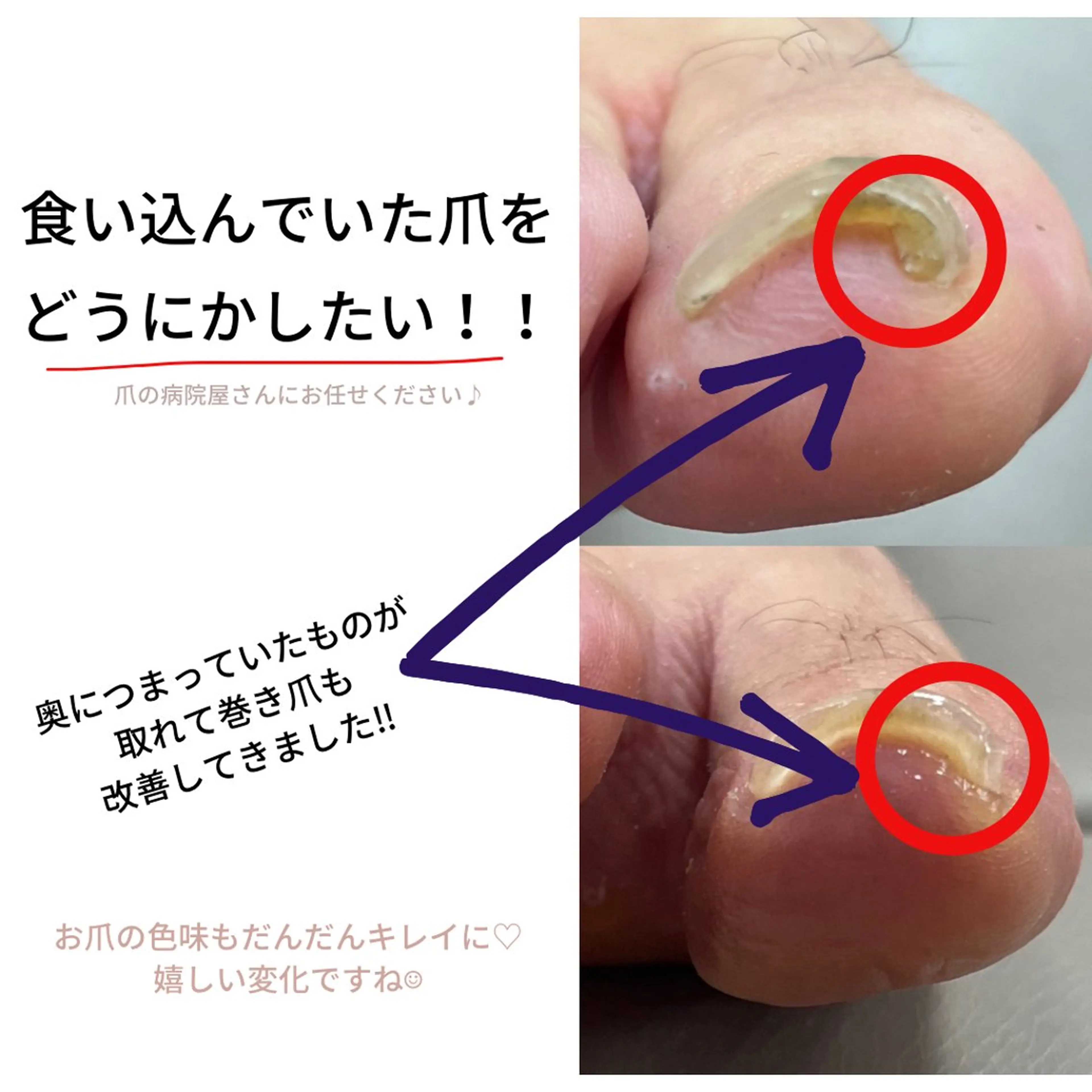 ネイル Belulu所属・安齋 都のネイルデザイン