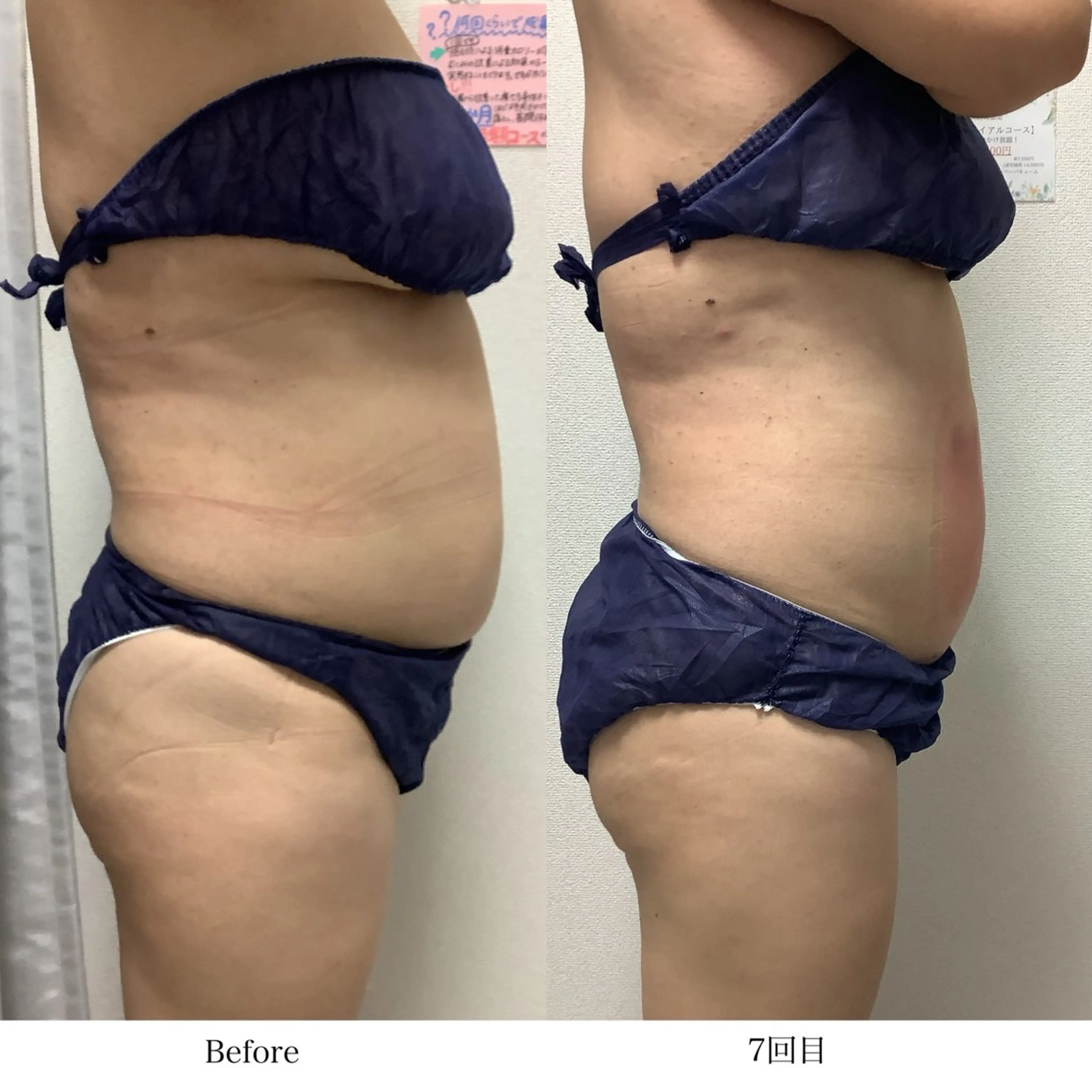 冷却専門店 SLARIのエステ・リラクイメージ