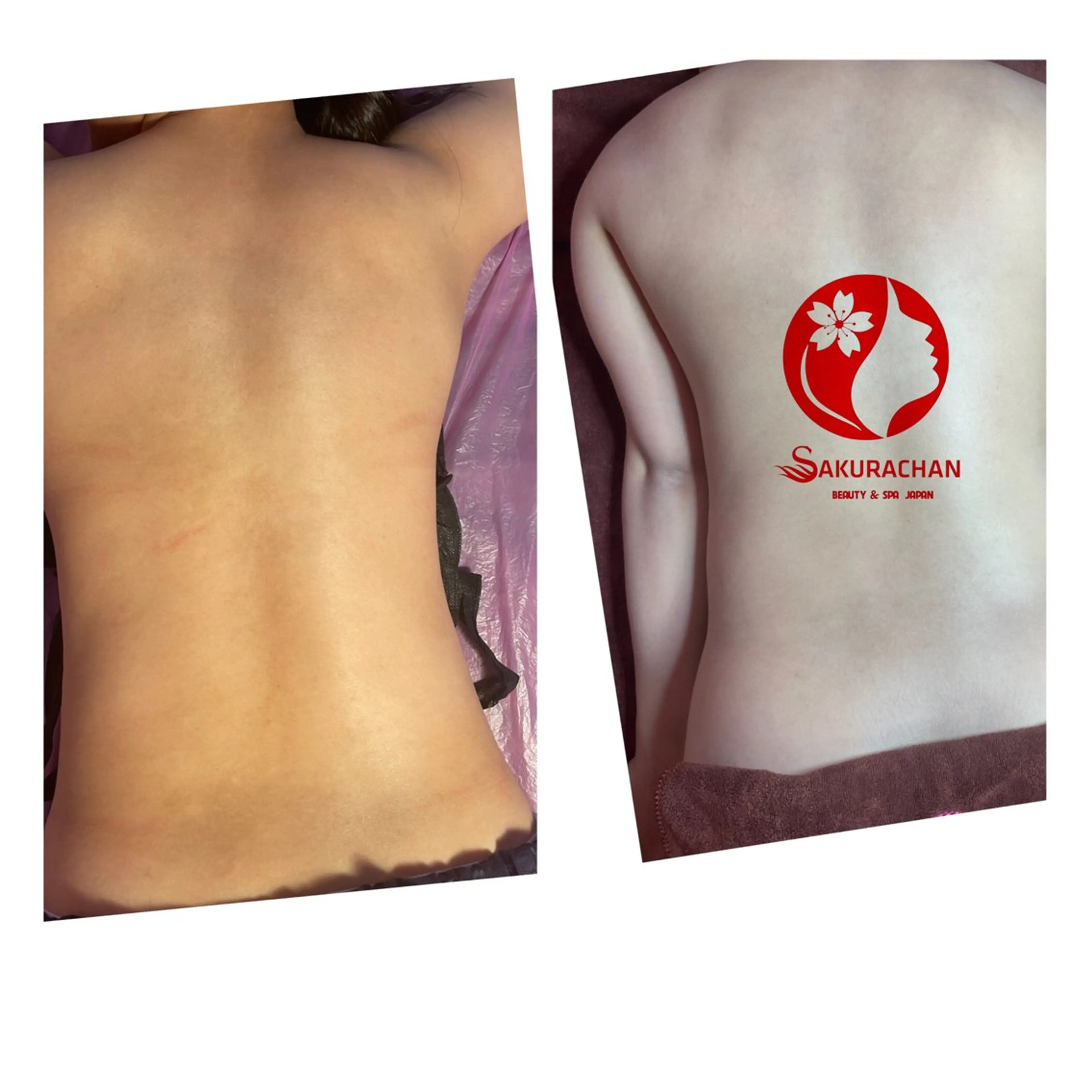 ニキビ、痩身、脱毛、 サクラチャンスパのエステ・リラクイメージ