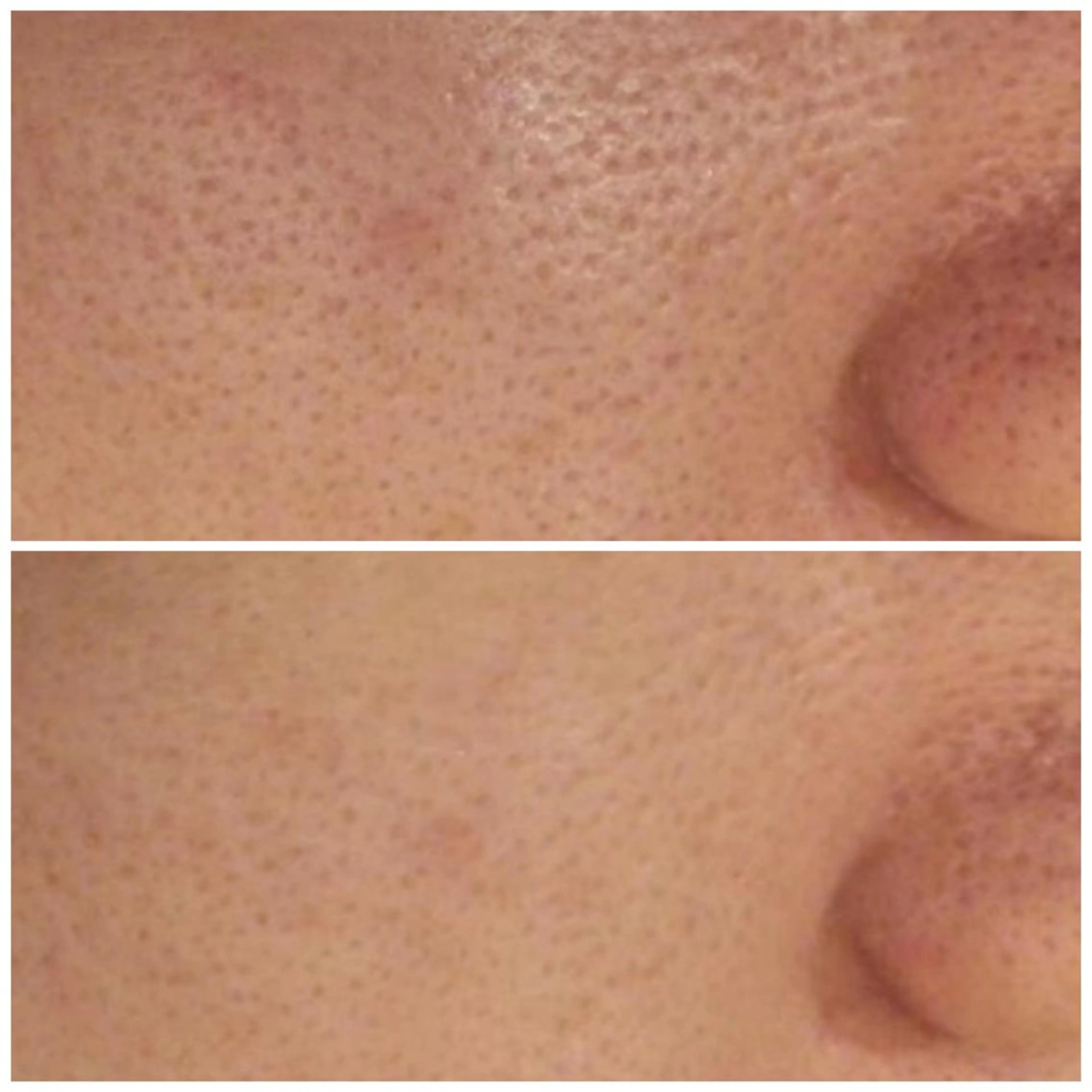 触れたくなる モテ肌へ...❤︎のエステ・リラクイメージ