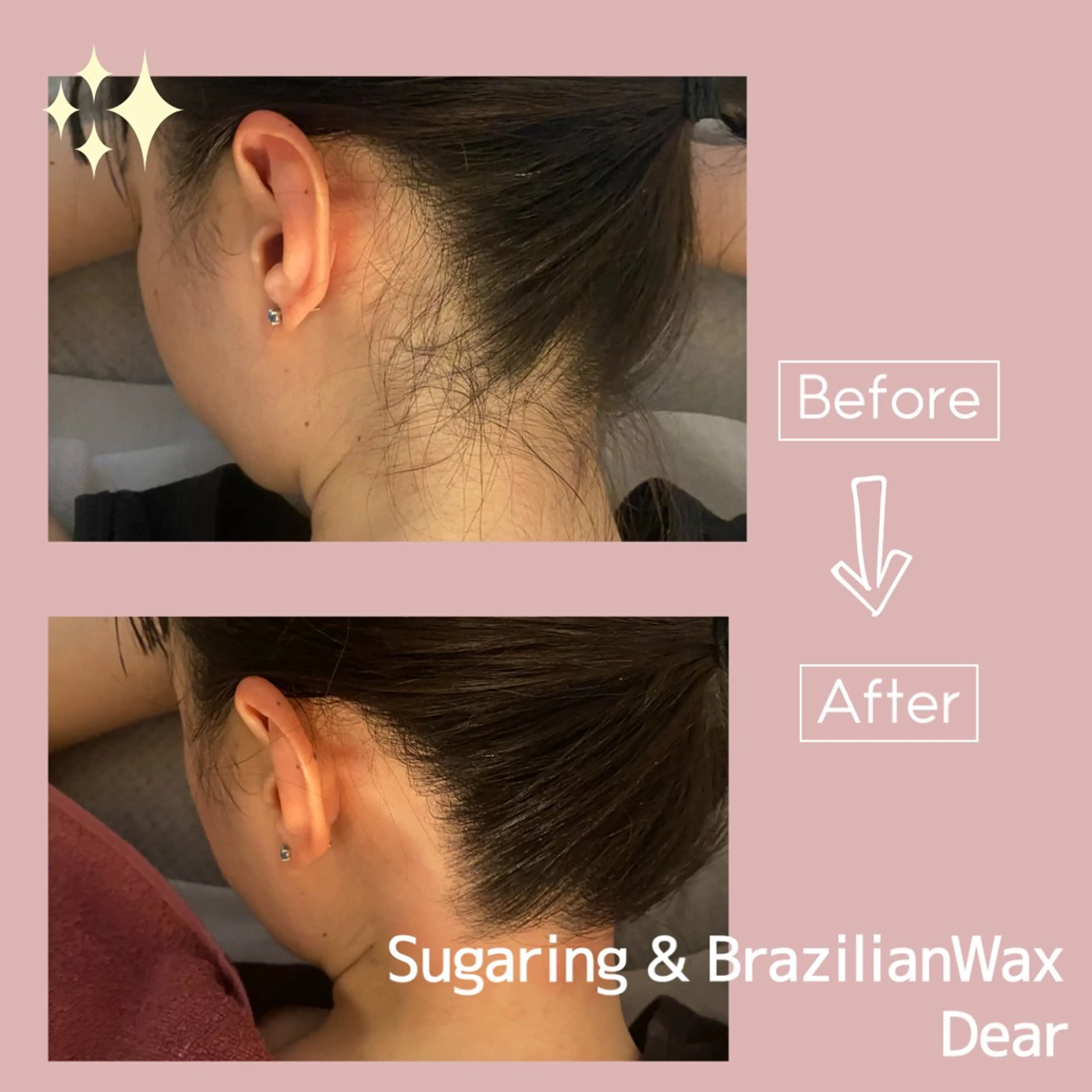 シュガーリング&ブラジリアンワックスサロンDear所属・シュガーリングサロン Dearのエステ・リラクイメージ