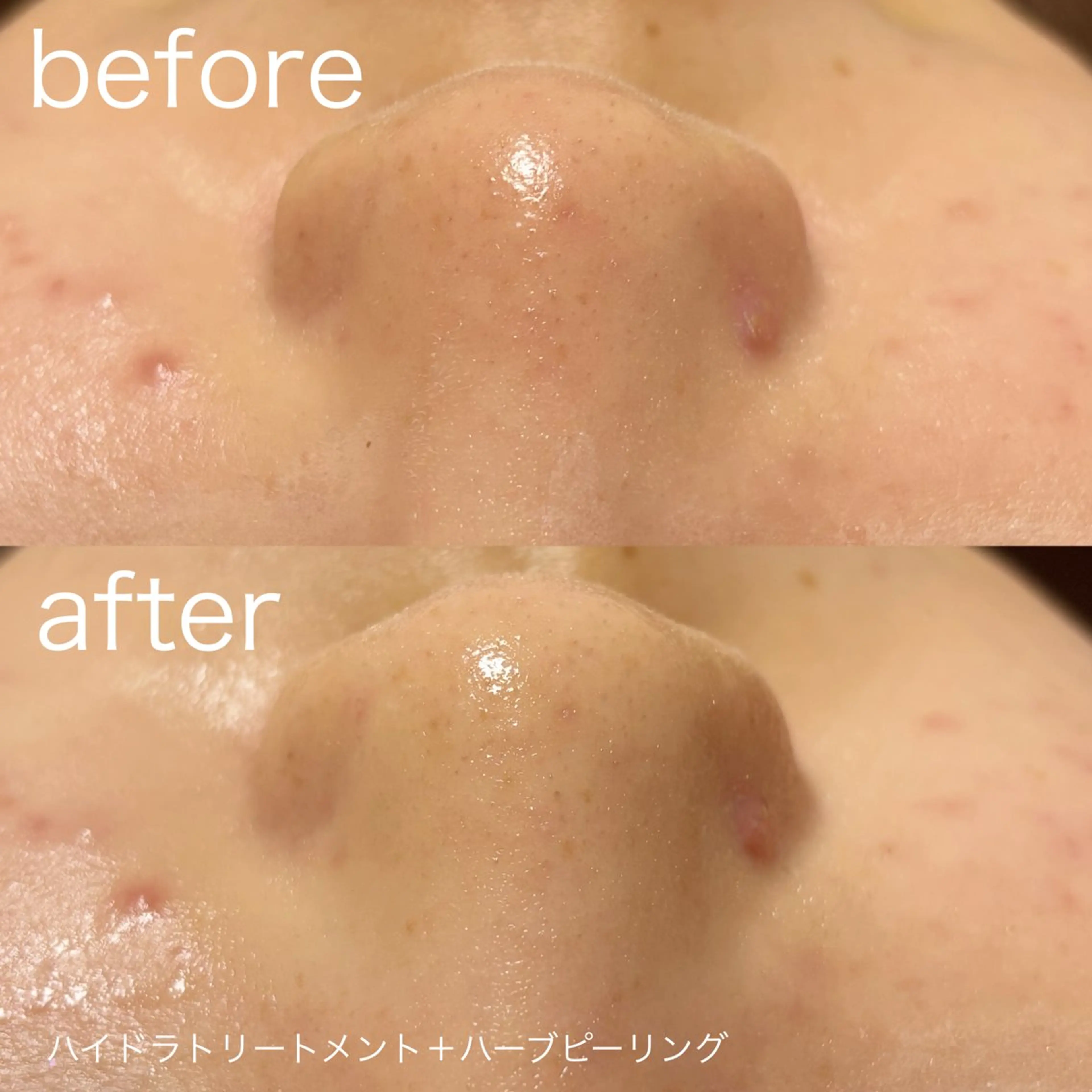 その他 lulularico Yuのエステ・リラクイメージ