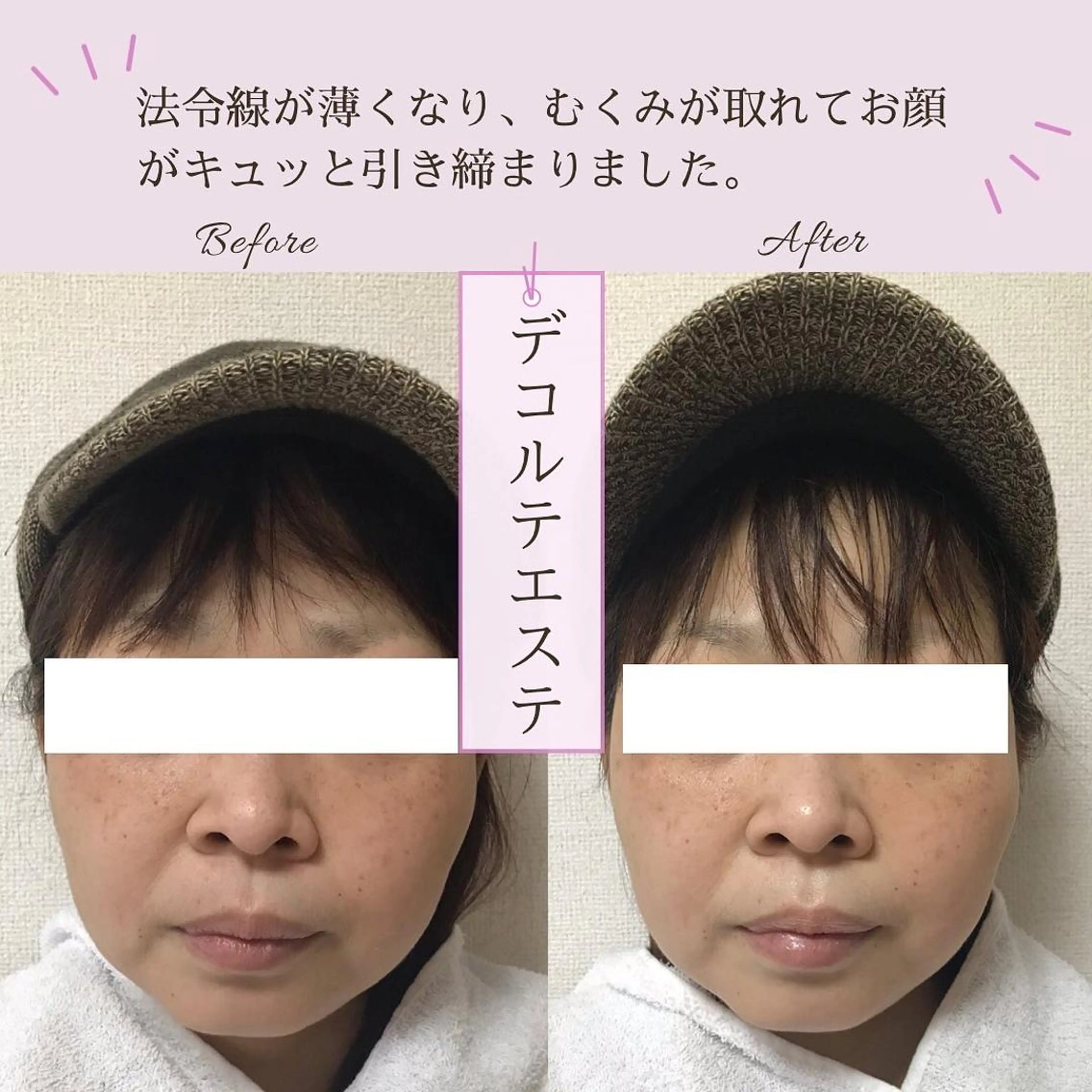 小顔エステサロン マインドール所属・泉大津エステ毛穴   シミ専門サロンのエステ・リラクイメージ