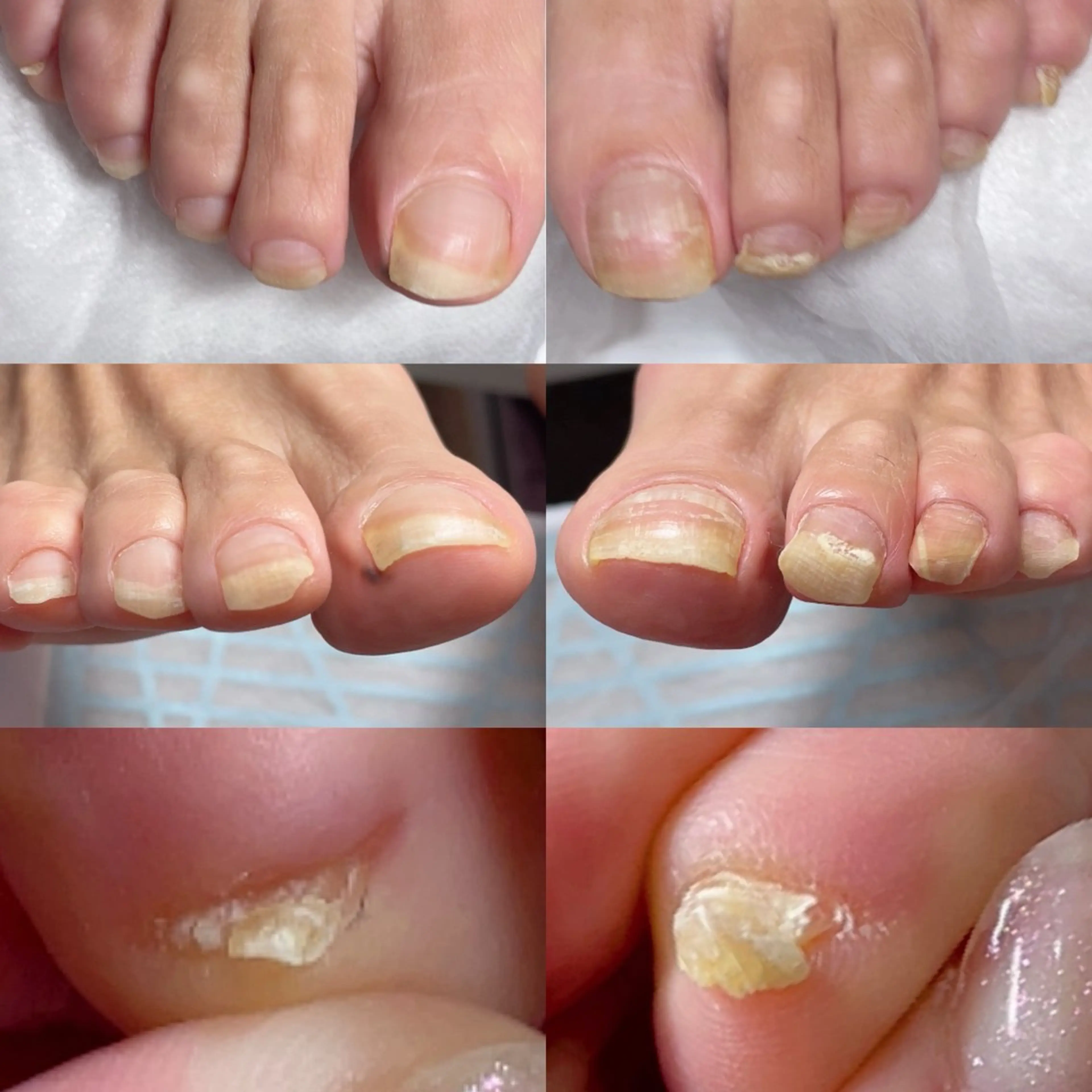 ネイル フットネイル フットネイル .Nails Mio 赤羽西ネイルサロンのネイルデザイン