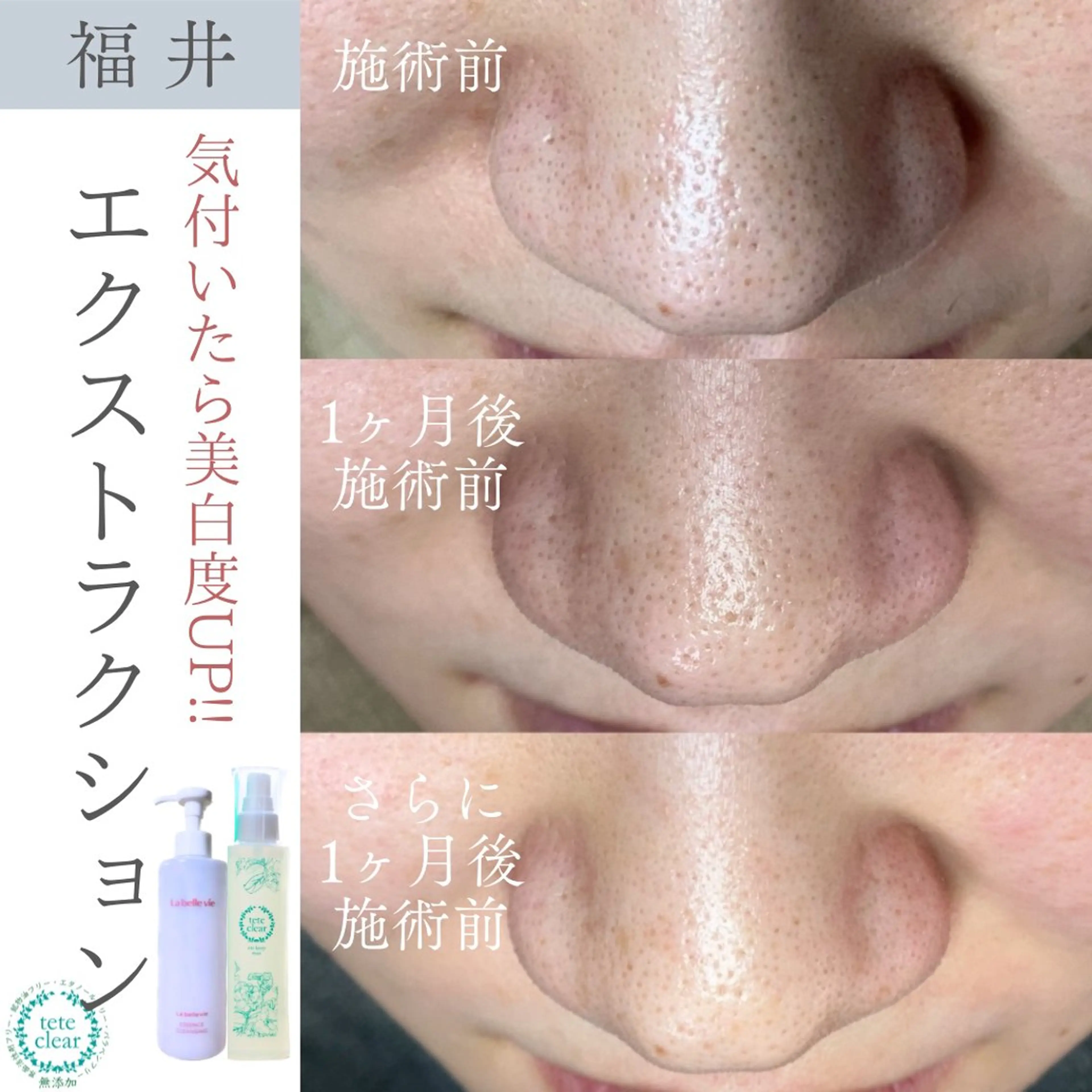 エステ リラク 毛穴ケア専門サロン Yourmeユアミーのエステ・リラクイメージ