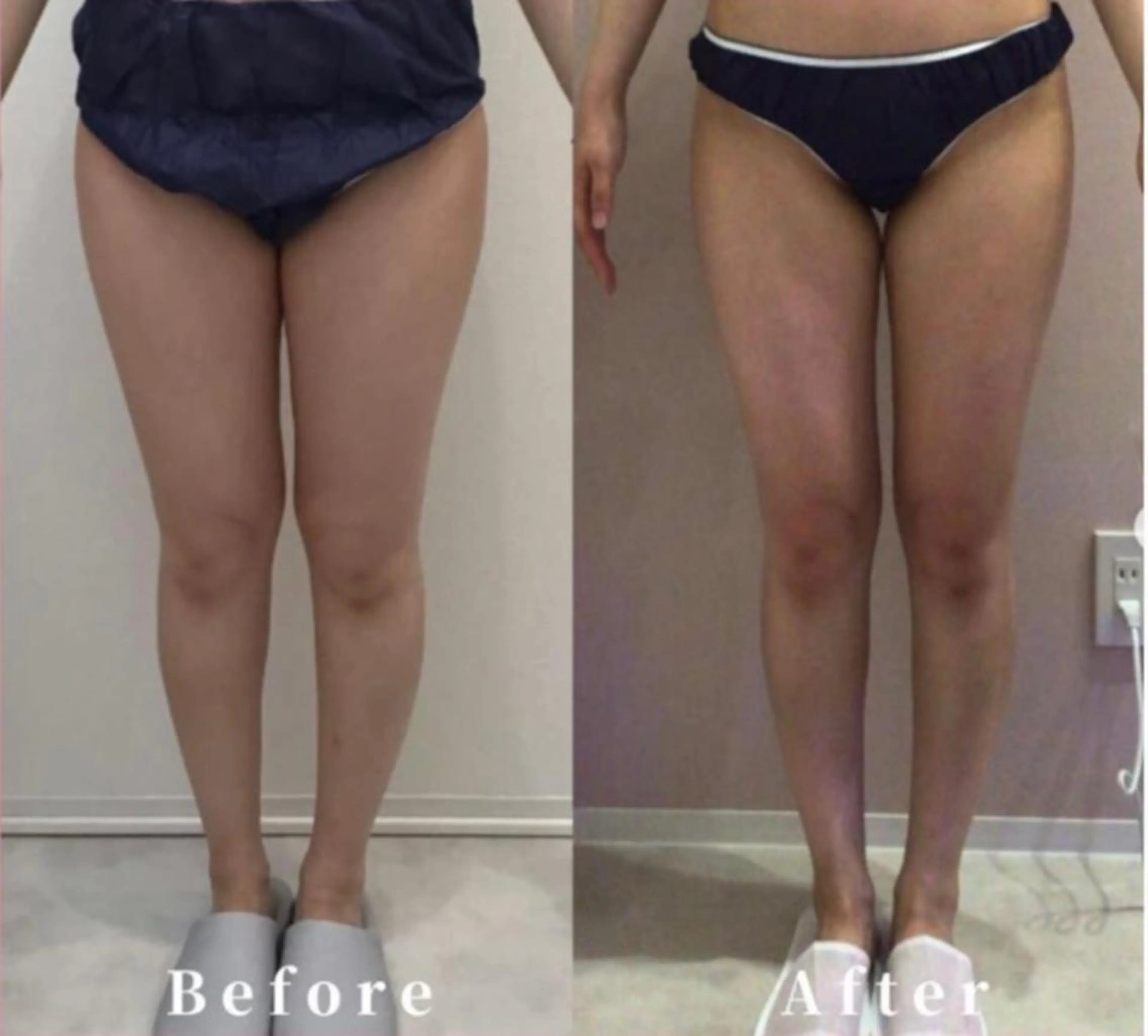 エステ beautysalon SAKUセンター南所属・ビューティーサロン SAKU センター南のエステ・リラクイメージ