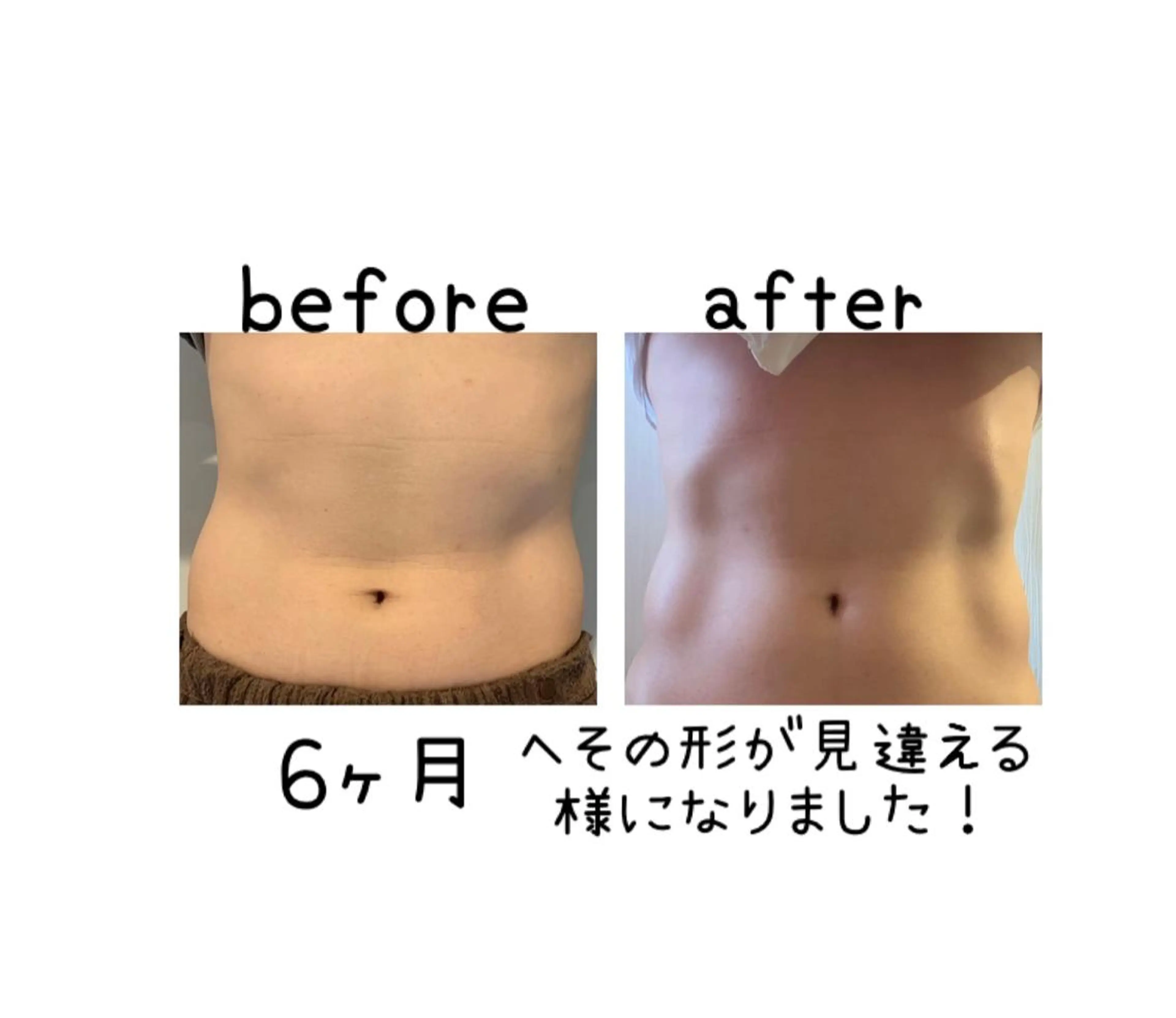 メンズ 癒し腸もみサロン シャユーム　ゆきなのその他イメージ
