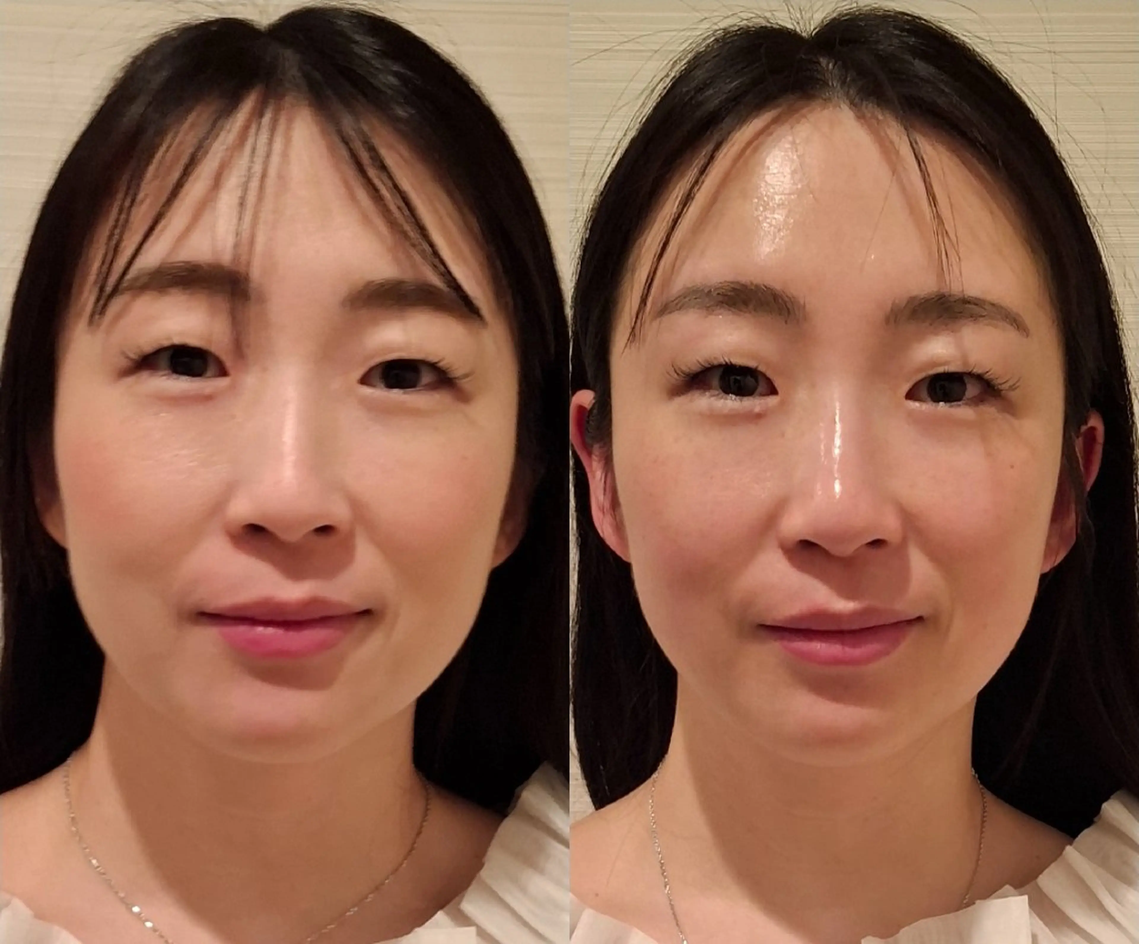 バリューネクスト所属・沢田 せつ子のエステ・リラクイメージ
