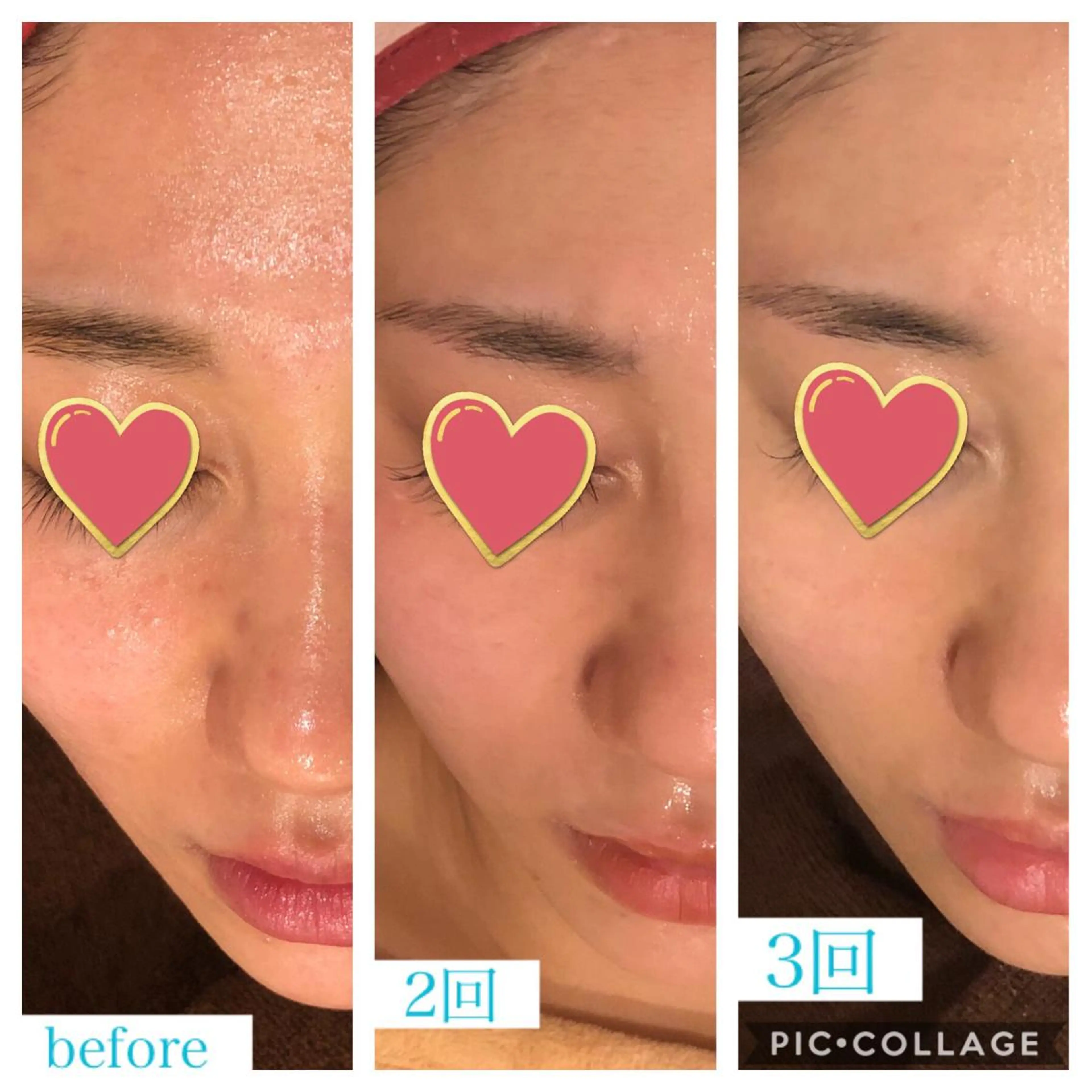 ミディアム カラー パーマ ヘアアレンジ キッズ ネイル マツエク・マツパ エステ リラク Ensor Clair所属・EnsorClair 代表 野口真央のエステ・リラクイメージ