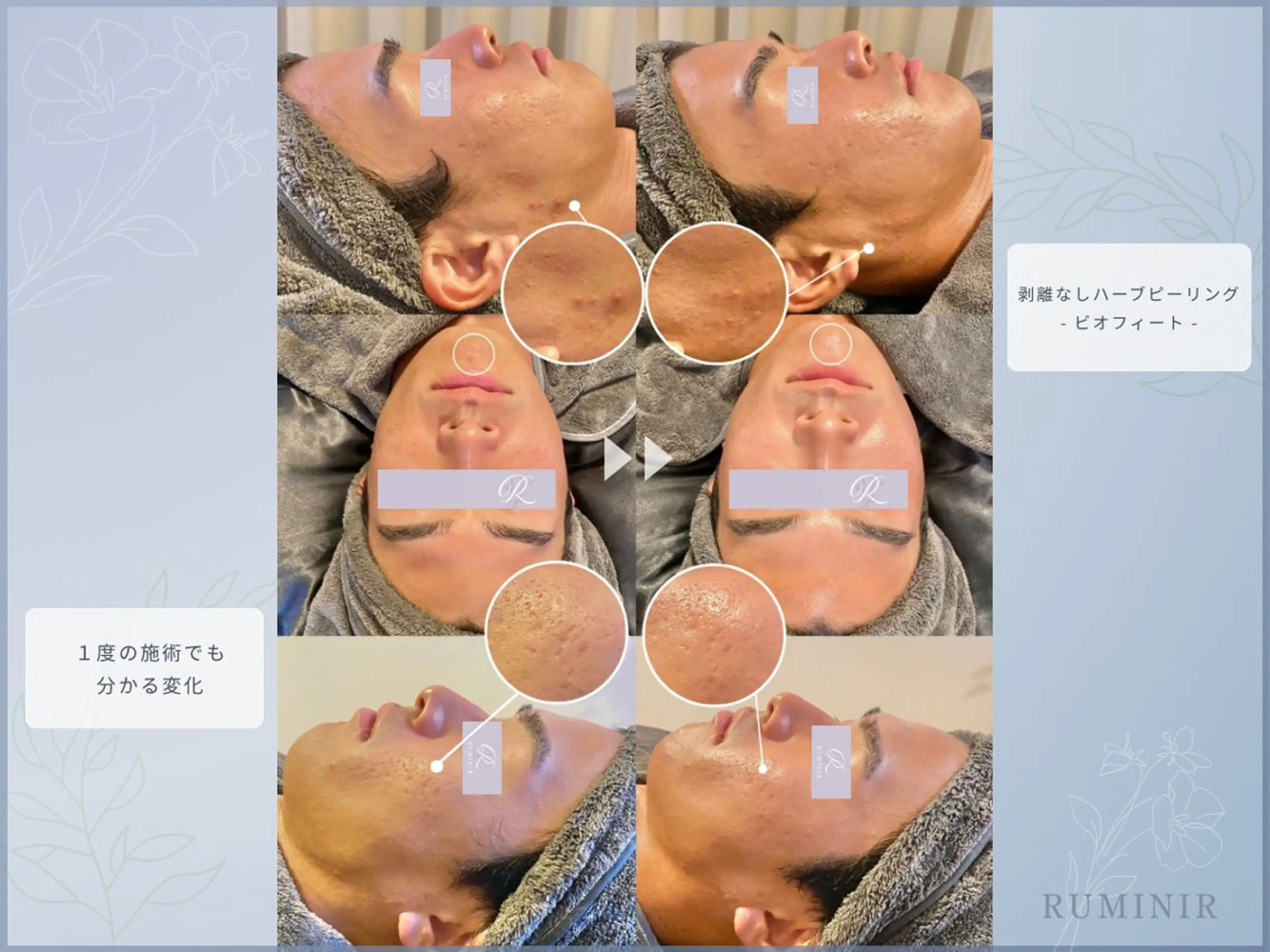 RUMINIR -ルミニール-所属・【肌質ケアサロン】 RUMINIRのエステ・リラクイメージ