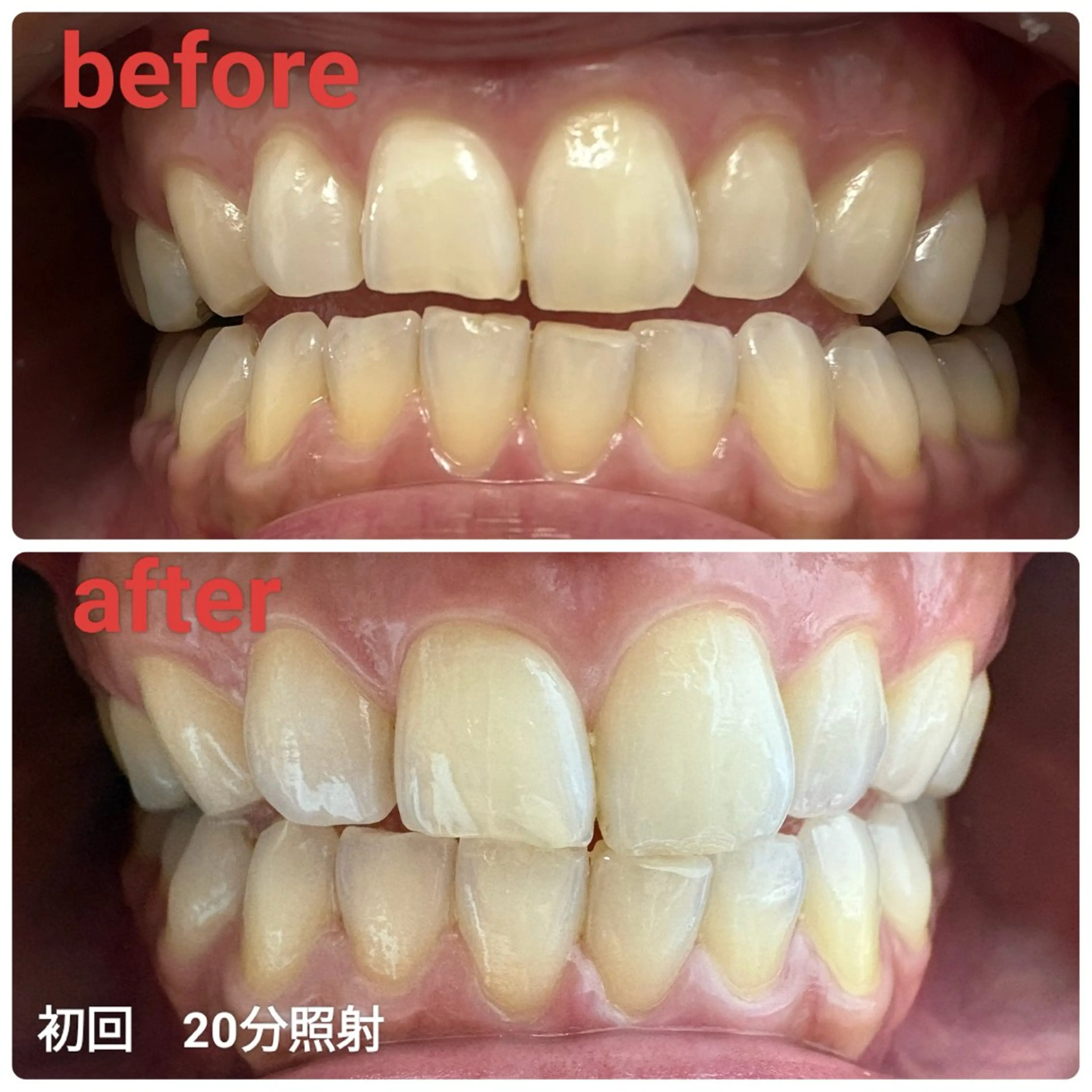 ホワイトニングサロンaile所属・セルフホワイトニング 金城しおりのその他イメージ