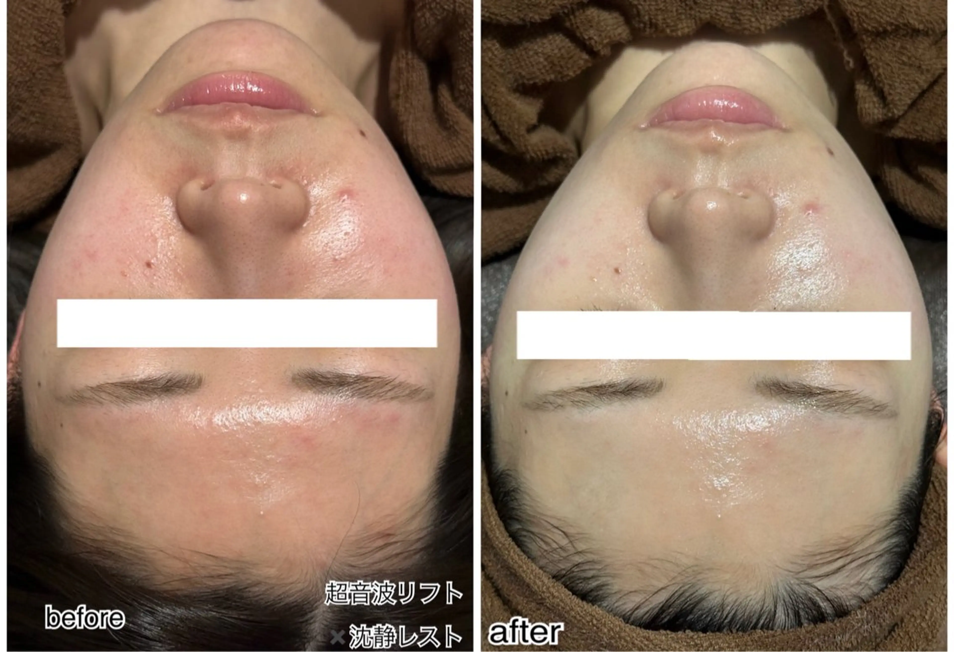 エステ ENCHANT 脱毛.小顔.毛穴のエステ・リラクイメージ