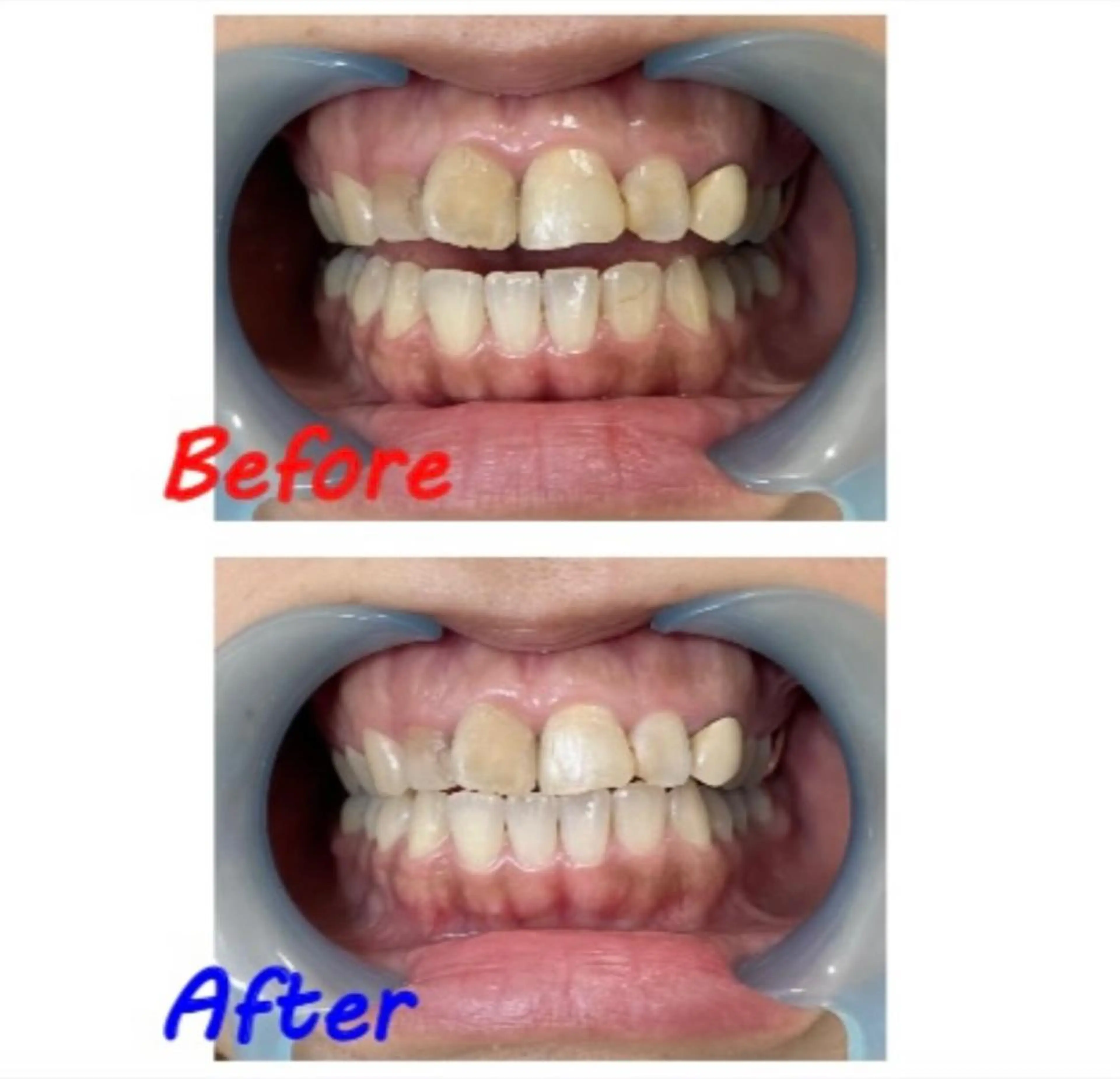 その他 セルフホワイトニングサロン　ラヴィアン所属・ホワイトニングサロン La vie enのその他イメージ