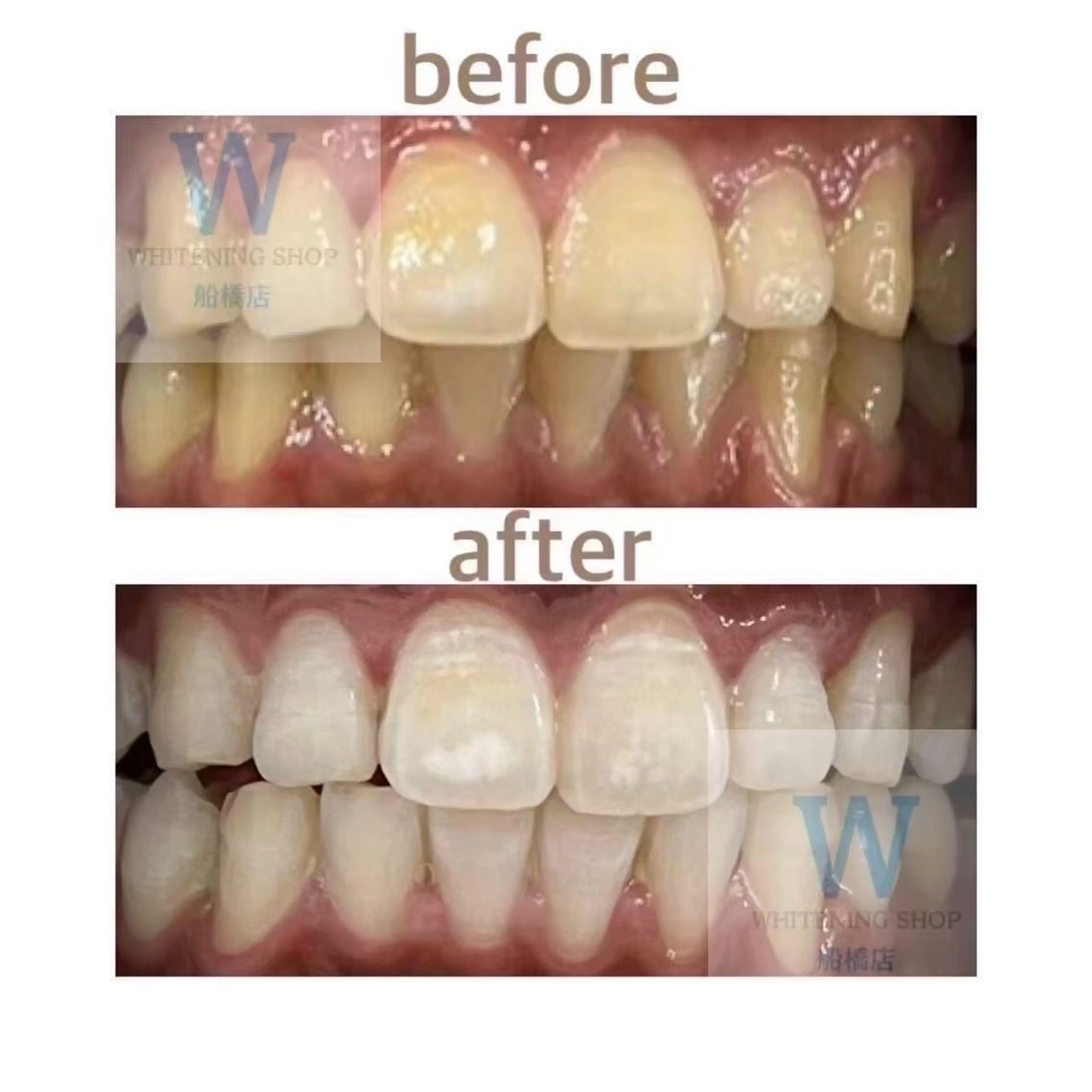 エステ リラク ホワイトニング ショップ船橋店のエステ・リラクイメージ