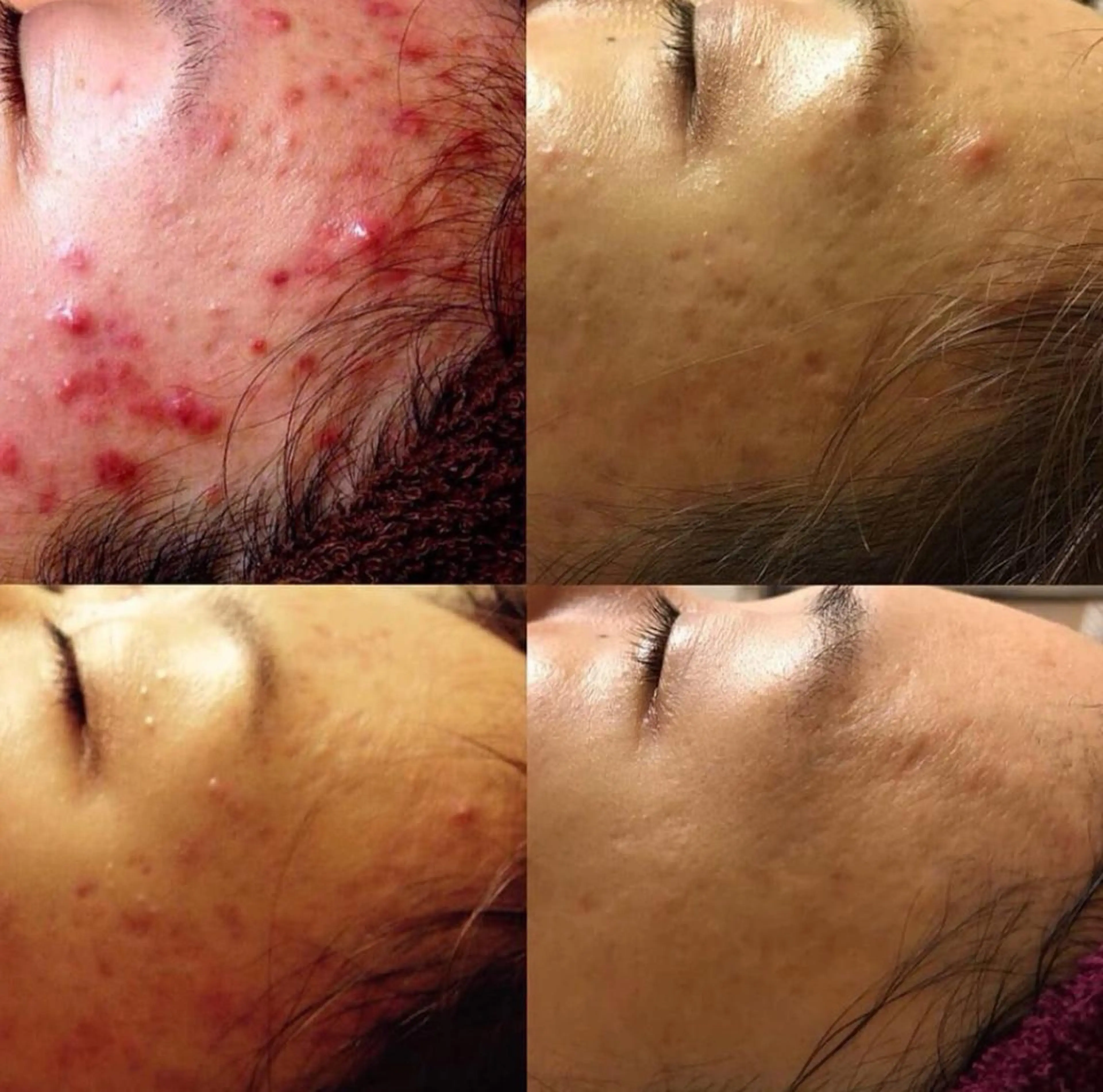 エステ Fleur beauty salon所属・Fleur 児玉聖子のエステ・リラクイメージ