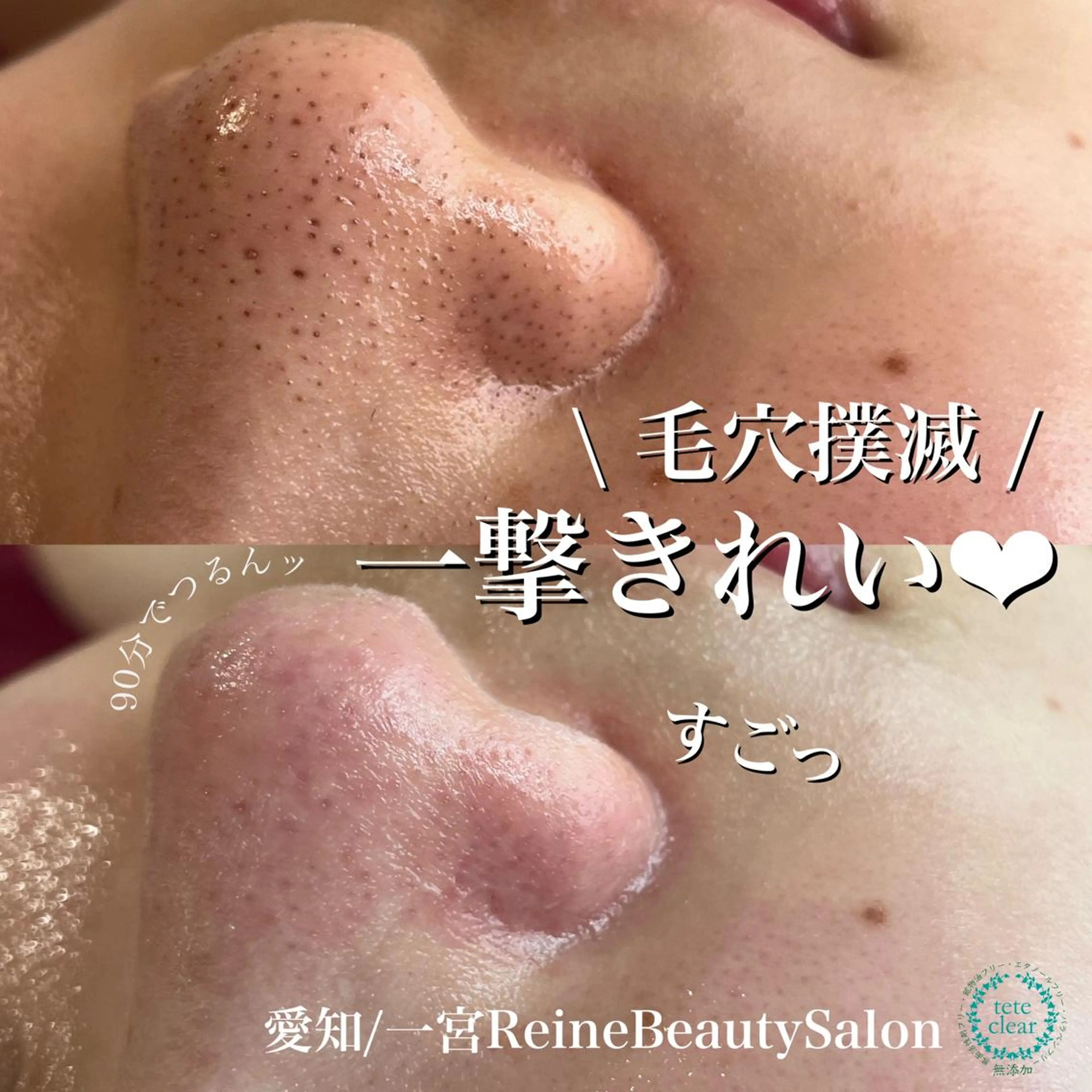 エステ Reine BeautySalon所属・毛穴/シミ肝斑/脱毛 横山梨里のエステ・リラクイメージ