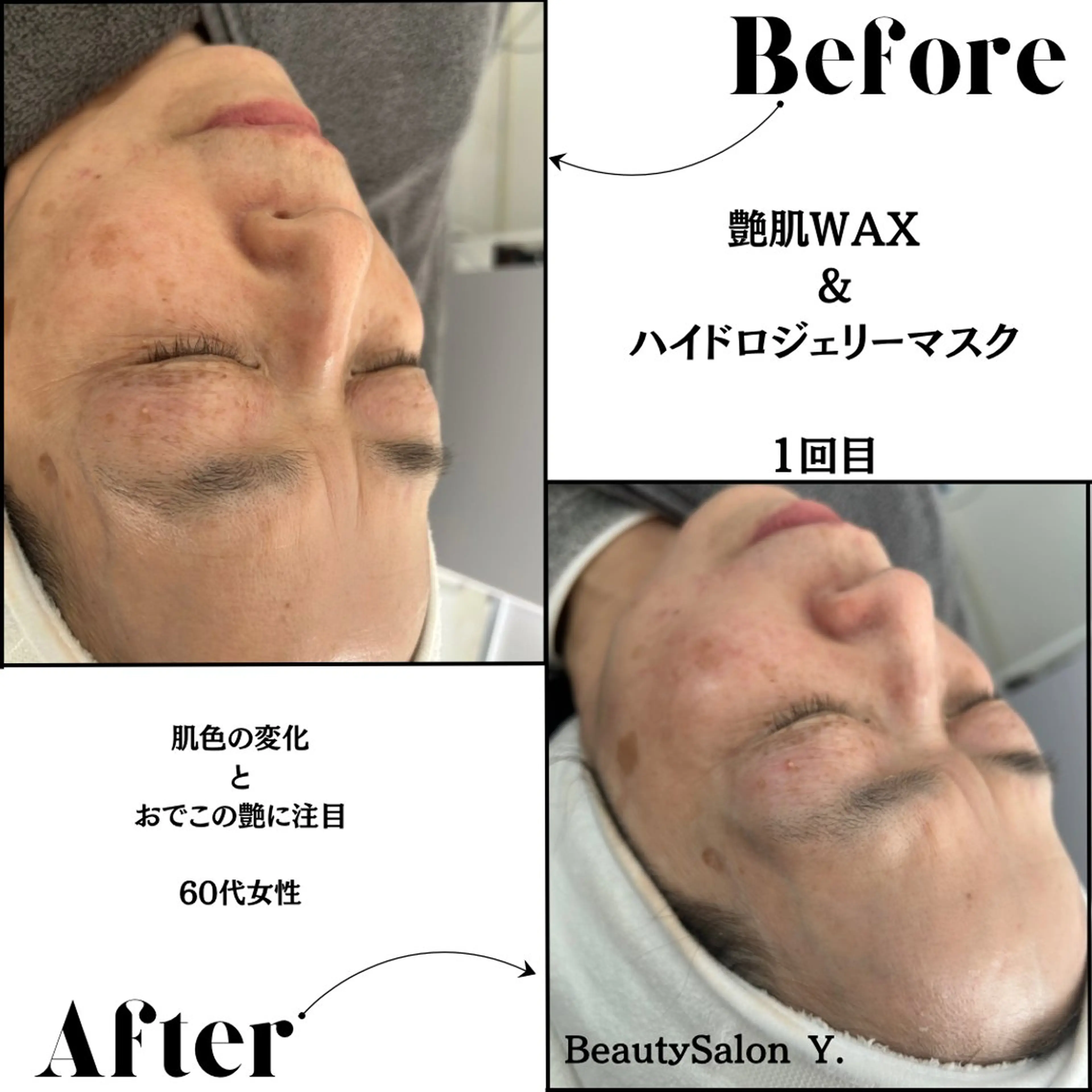 その他 体質／肌質改善専門店 Y.【ワイドット】のエステ・リラクイメージ