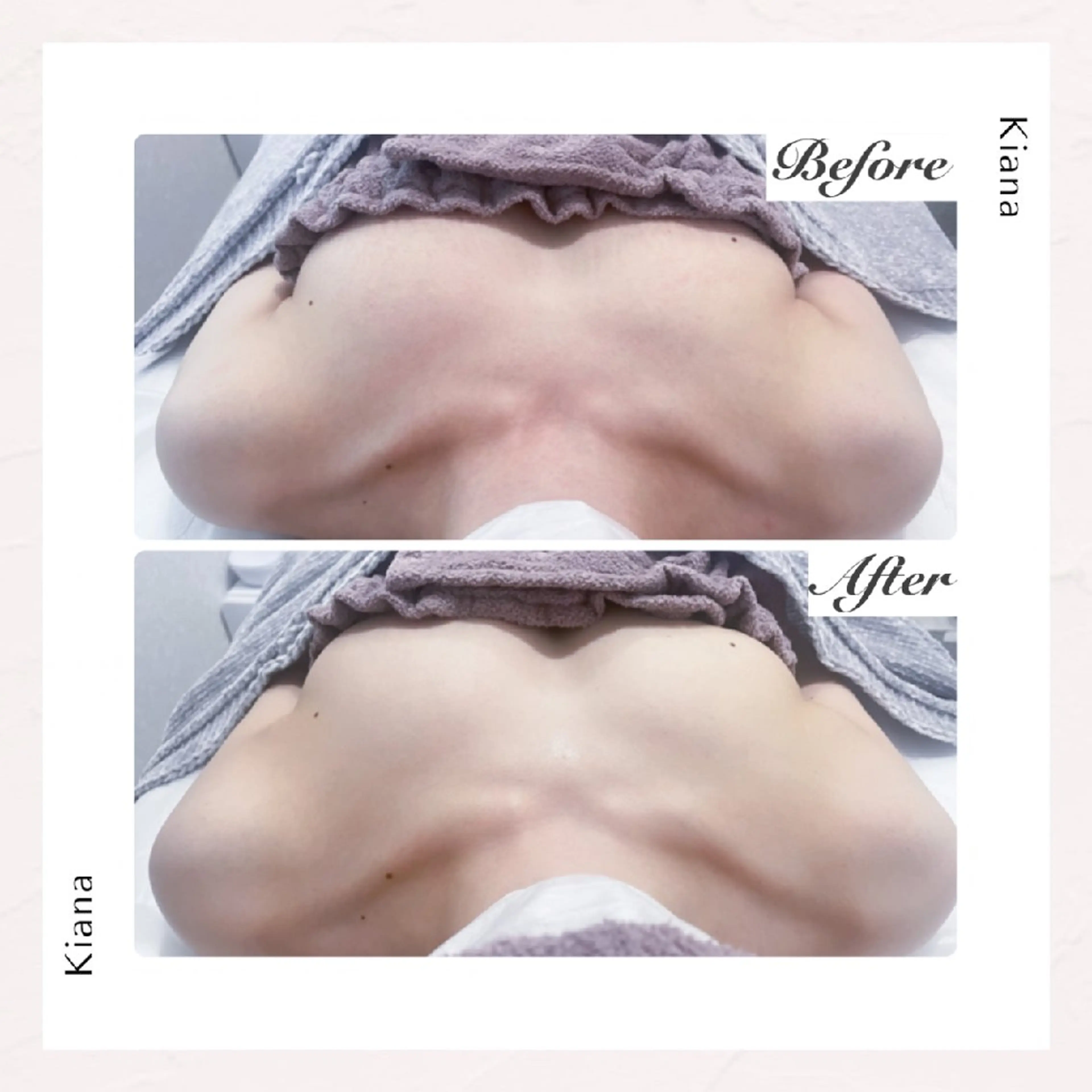 【バスト専門店 】 Kiana のエステ・リラクイメージ