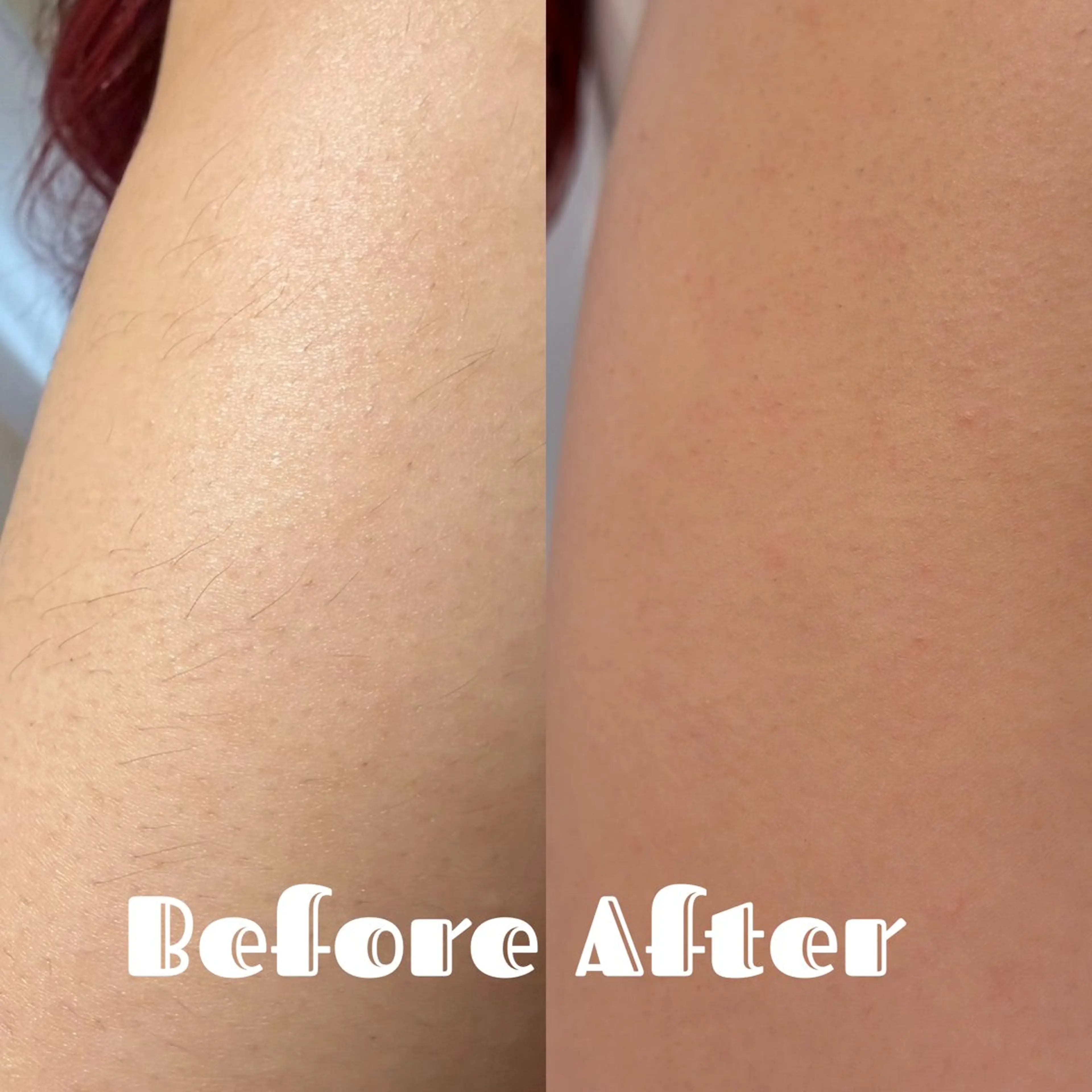 脱毛 高槻駅近/脱毛サロン【Salon Repo】所属・加代 結愛のエステ・リラクイメージ