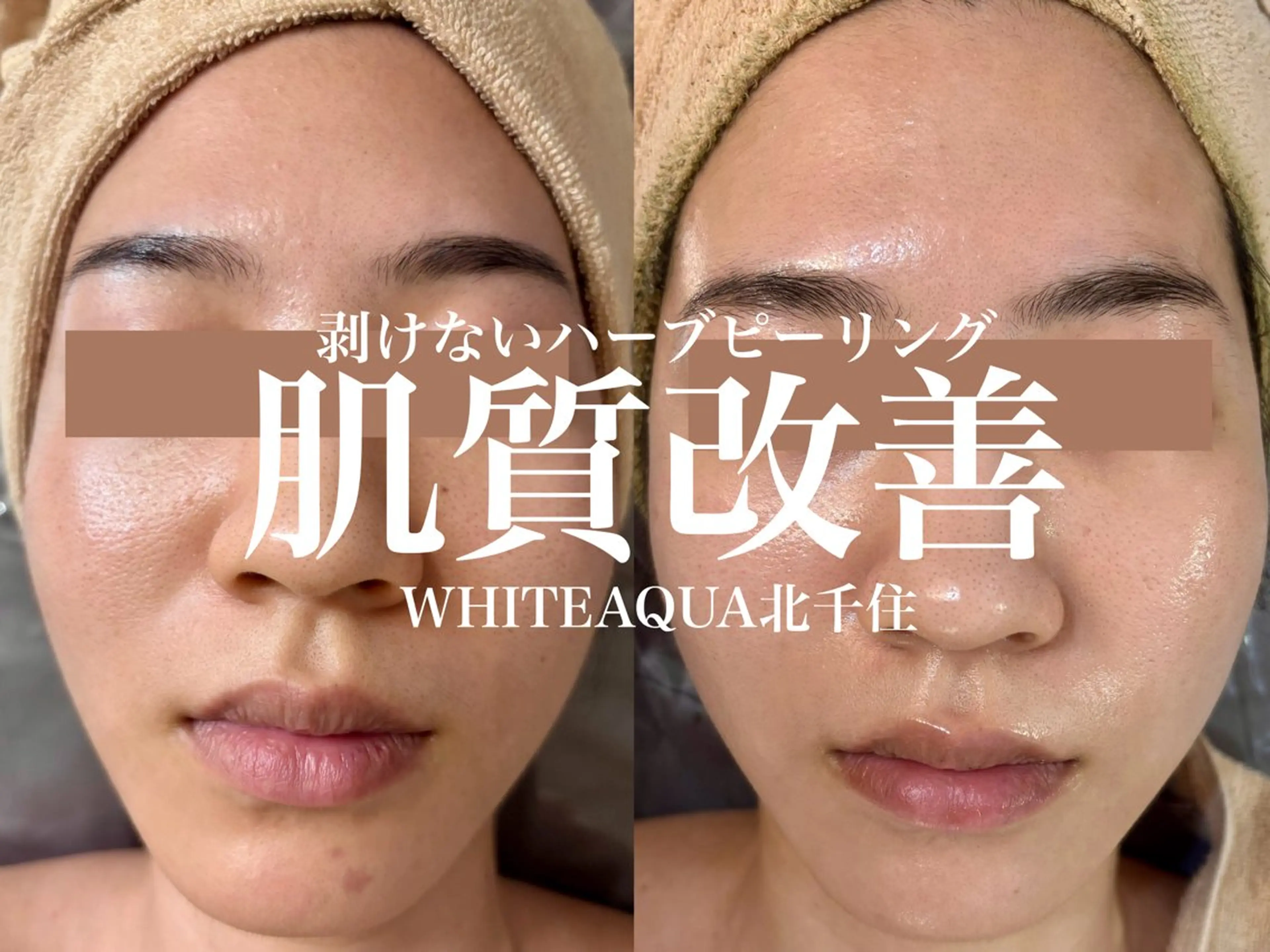 エステ WHITE AQUA 北千住店のエステ・リラクイメージ