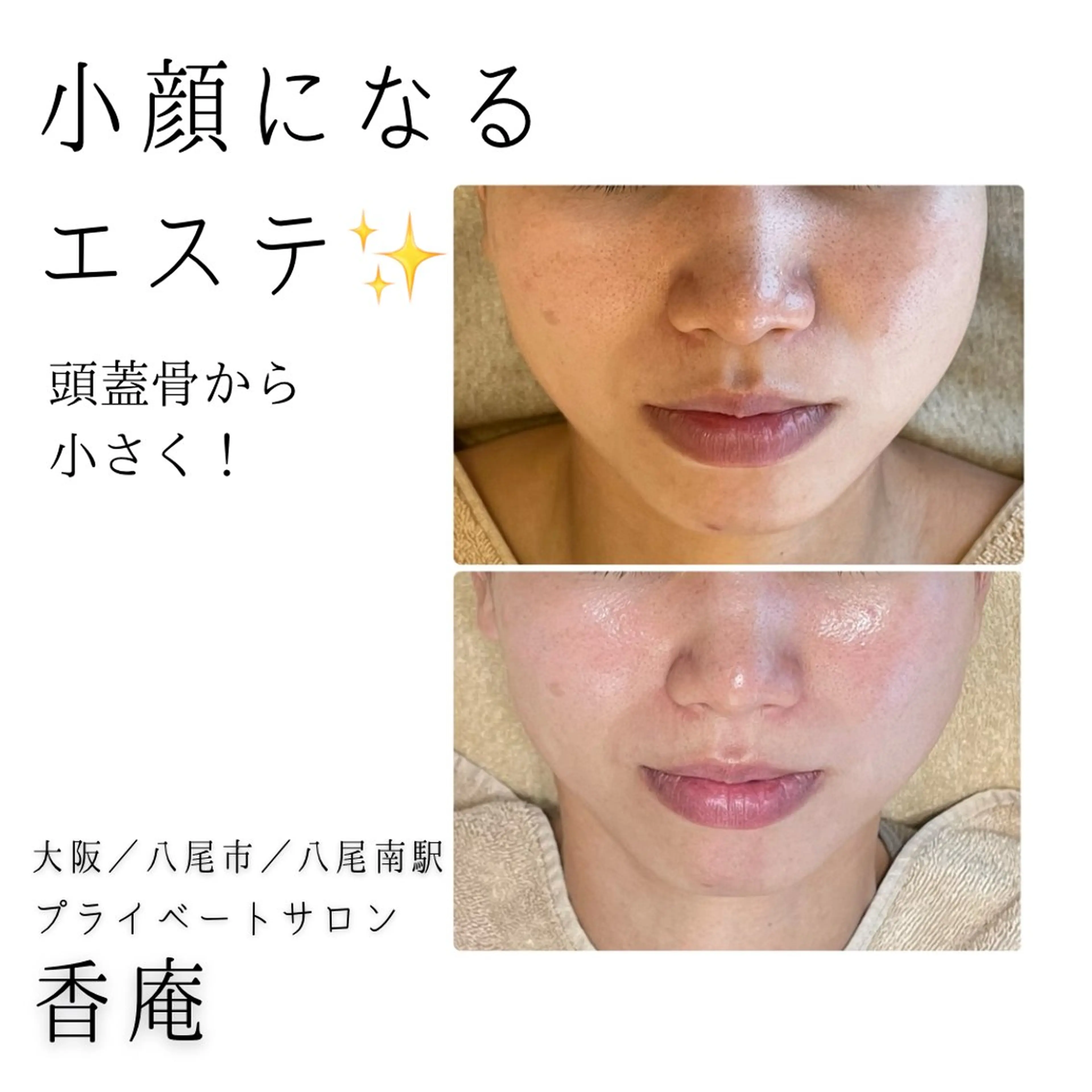 エステ リラク 小顔・たるみケア✨ フェイシャル&ボディのエステ・リラクイメージ