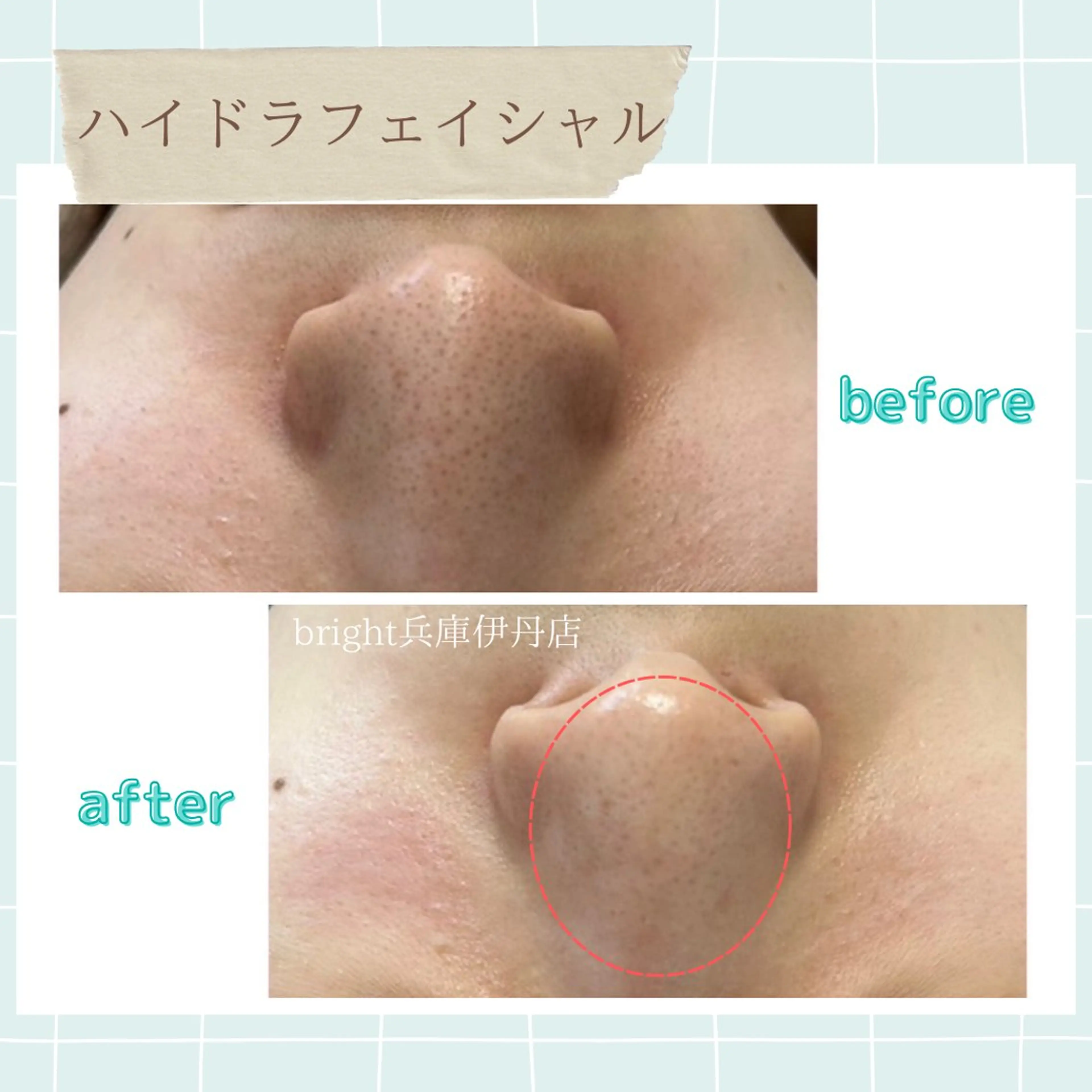 メンズ エステ お手軽ホワイトニングsalon mina所属・武元 奈津美のエステ・リラクイメージ
