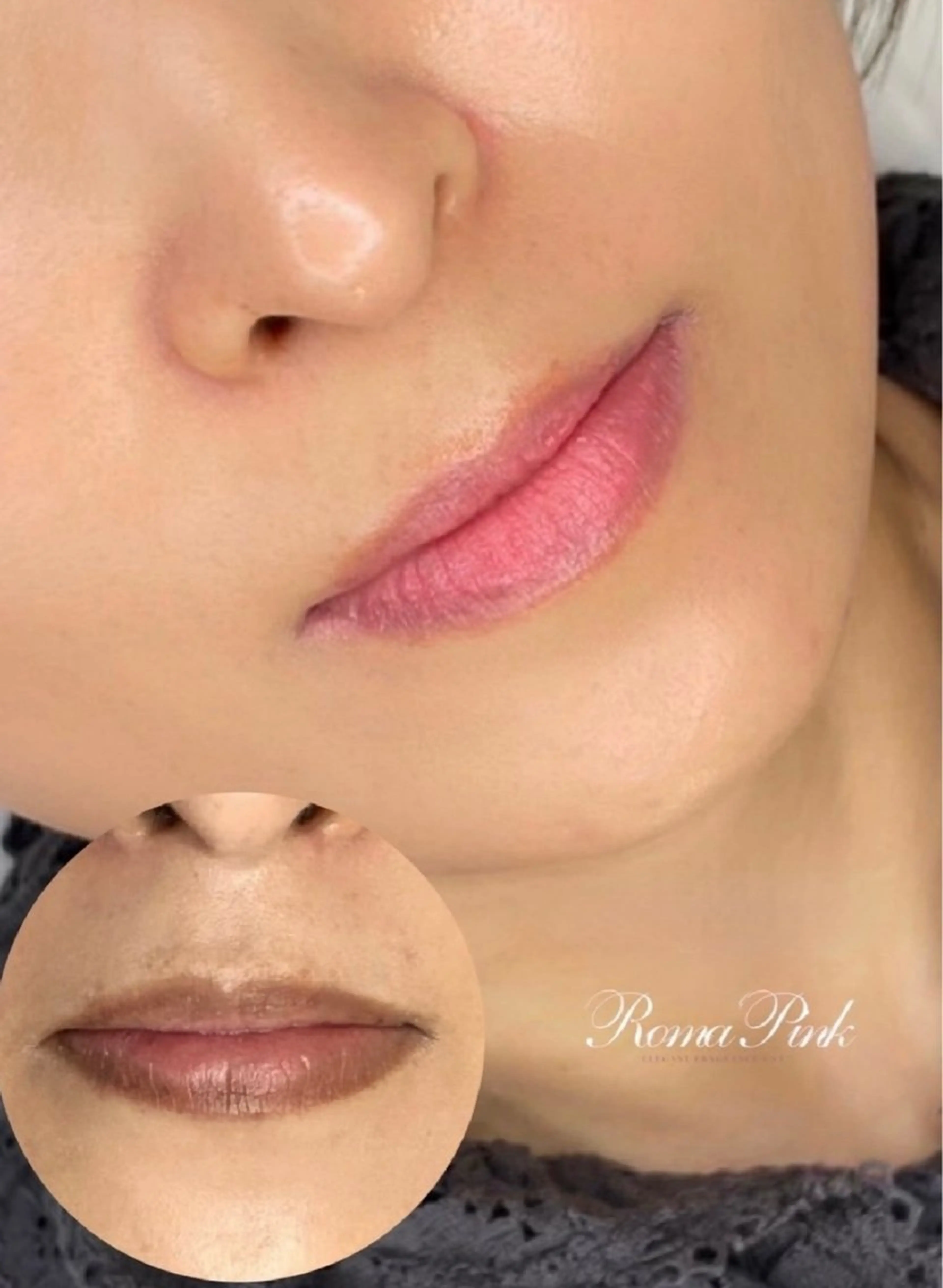ローマピンク 唇の写真
