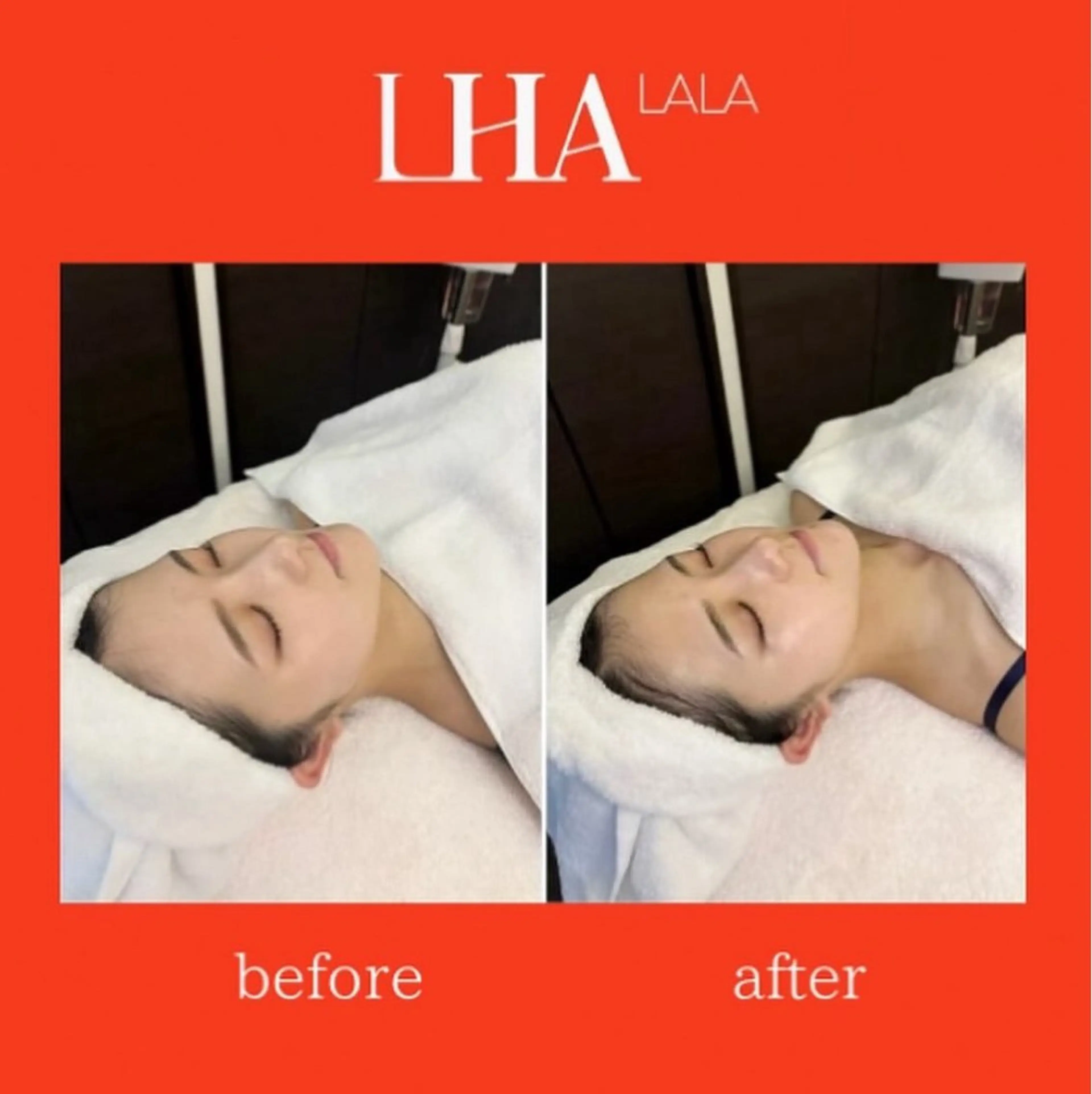 《透明感UP&うるツヤ仕上げ💎》ララピール＋ララパック付の写真