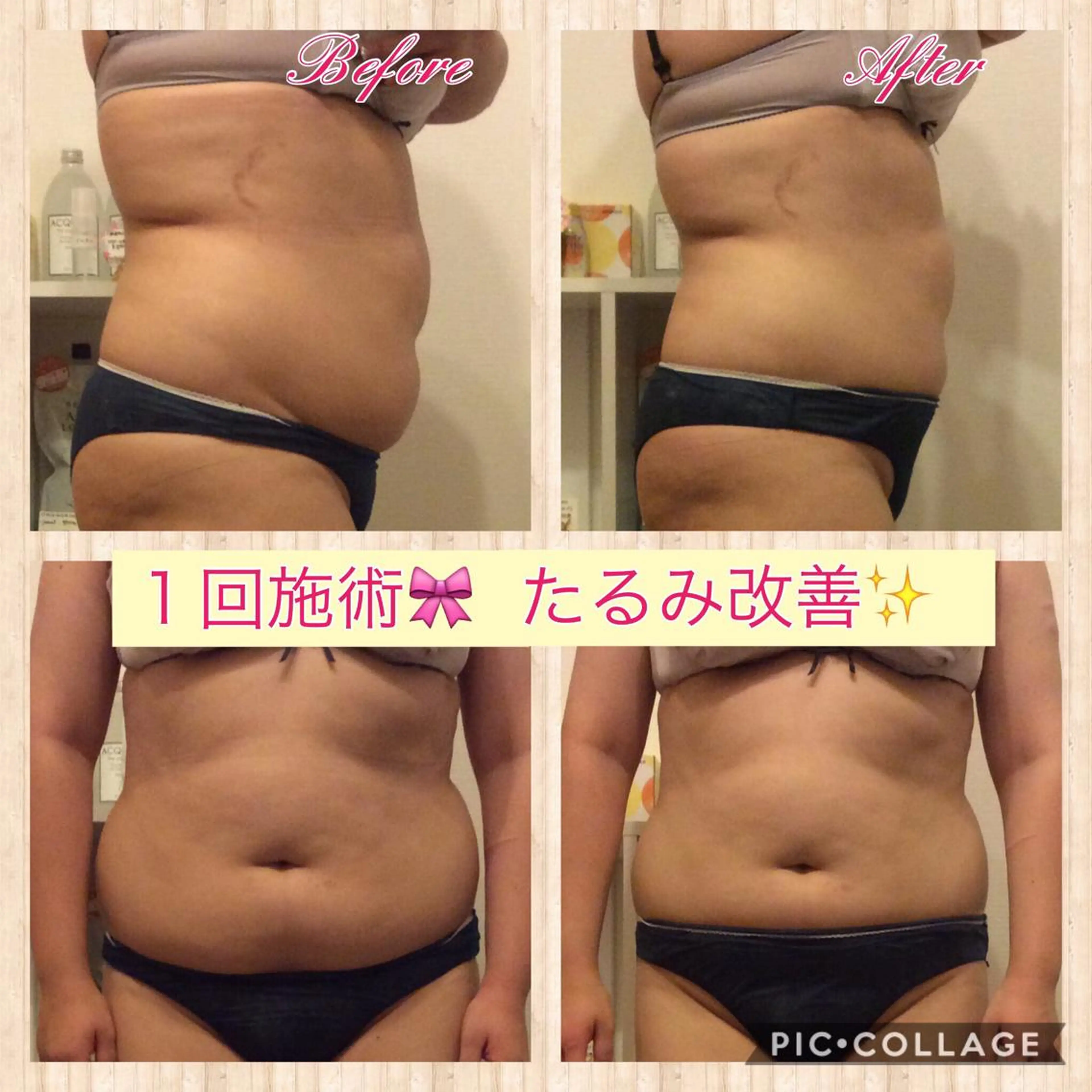 ダイエット・美肌ケア fleurのエステ・リラクイメージ