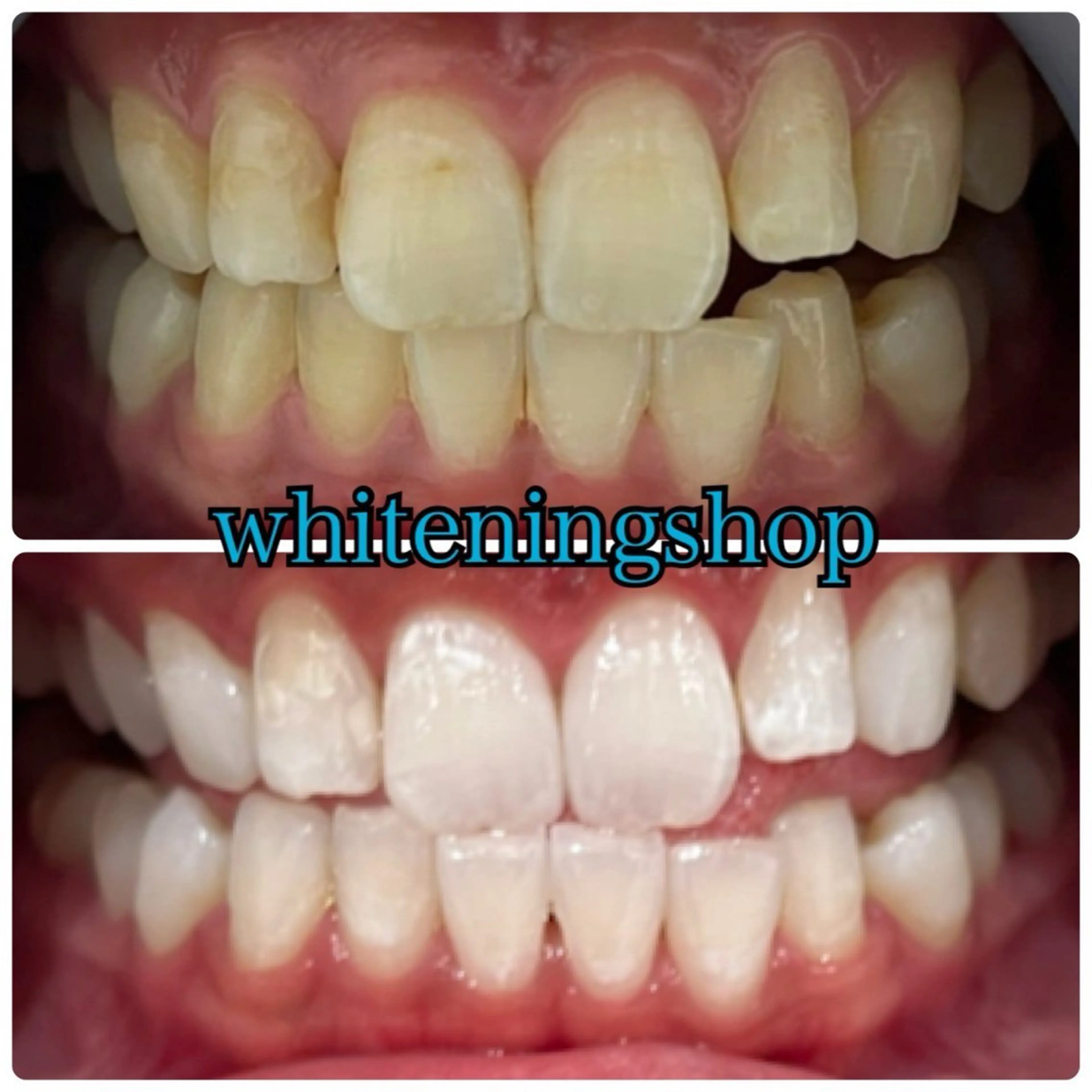 メンズ エステ リラク ホワイトニング ショップ川越店のエステ・リラクイメージ