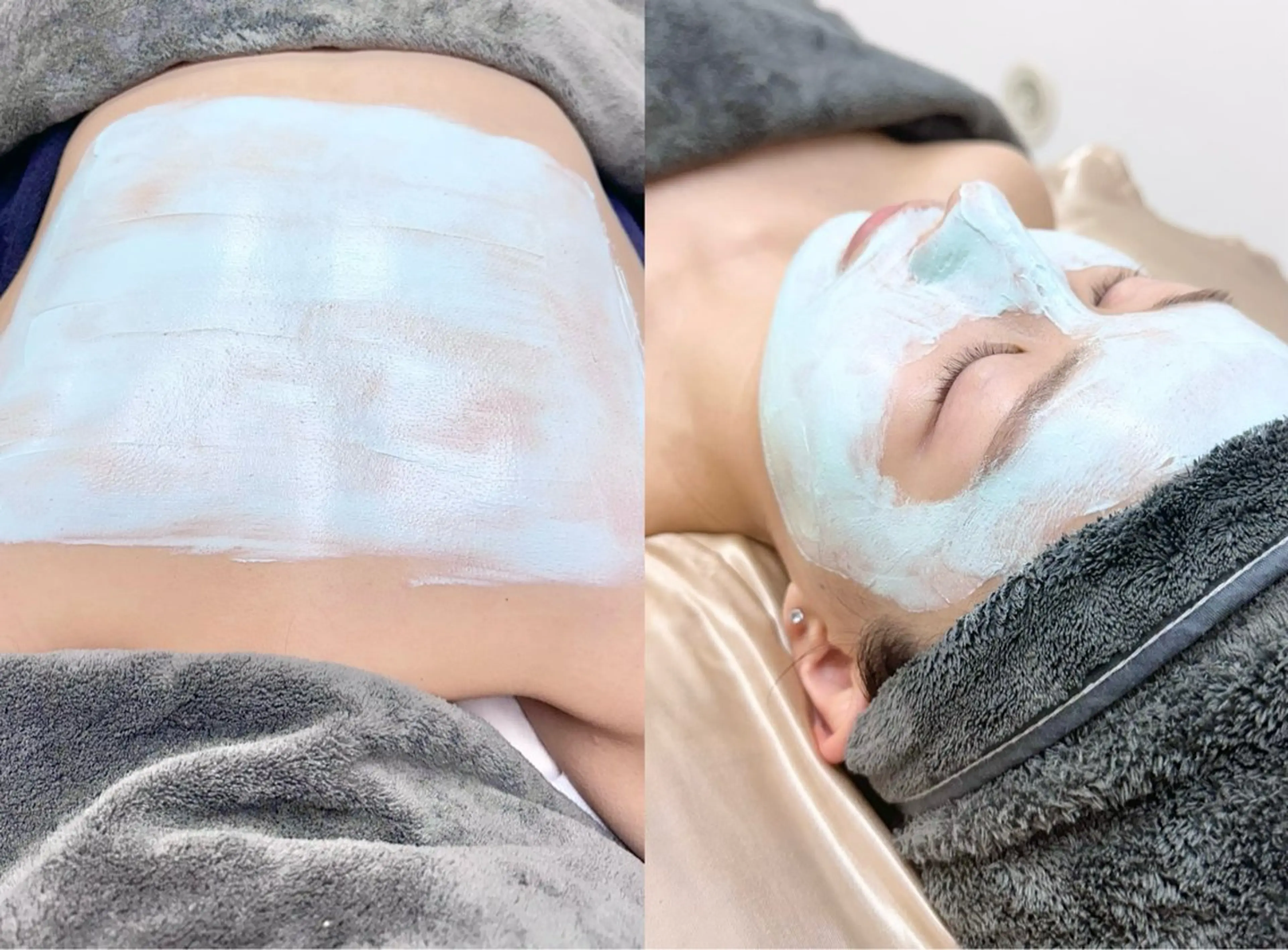 《モニター様限定》【繰り返しニキビ】乳酸菌ピーリング+鎮静トリートメント＋イオン導入｜クリスティーナ｜お顔orお背中の写真