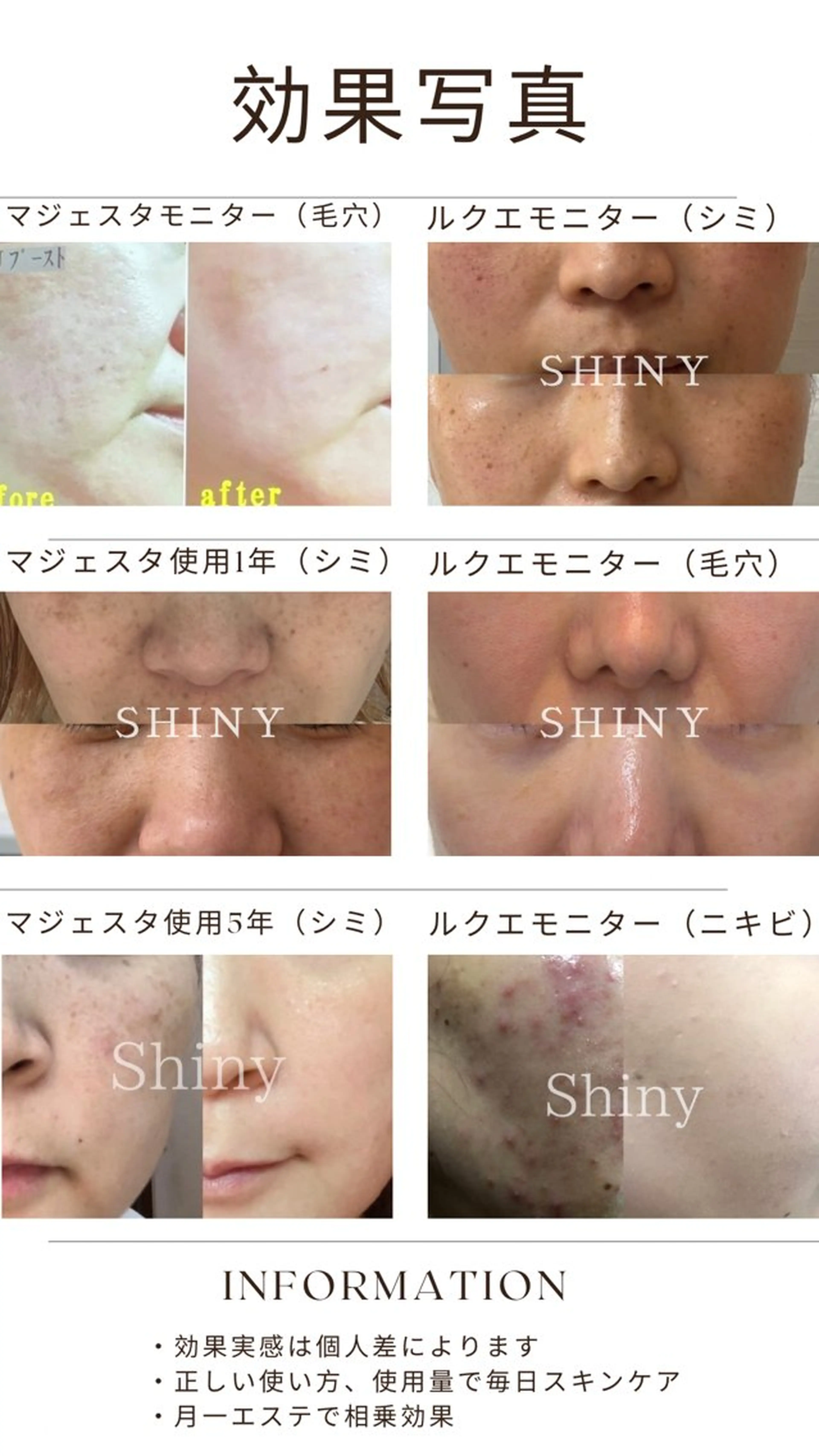 エステ Shiny所属・✨ナリス化粧品✨ Shinyのエステ・リラクイメージ