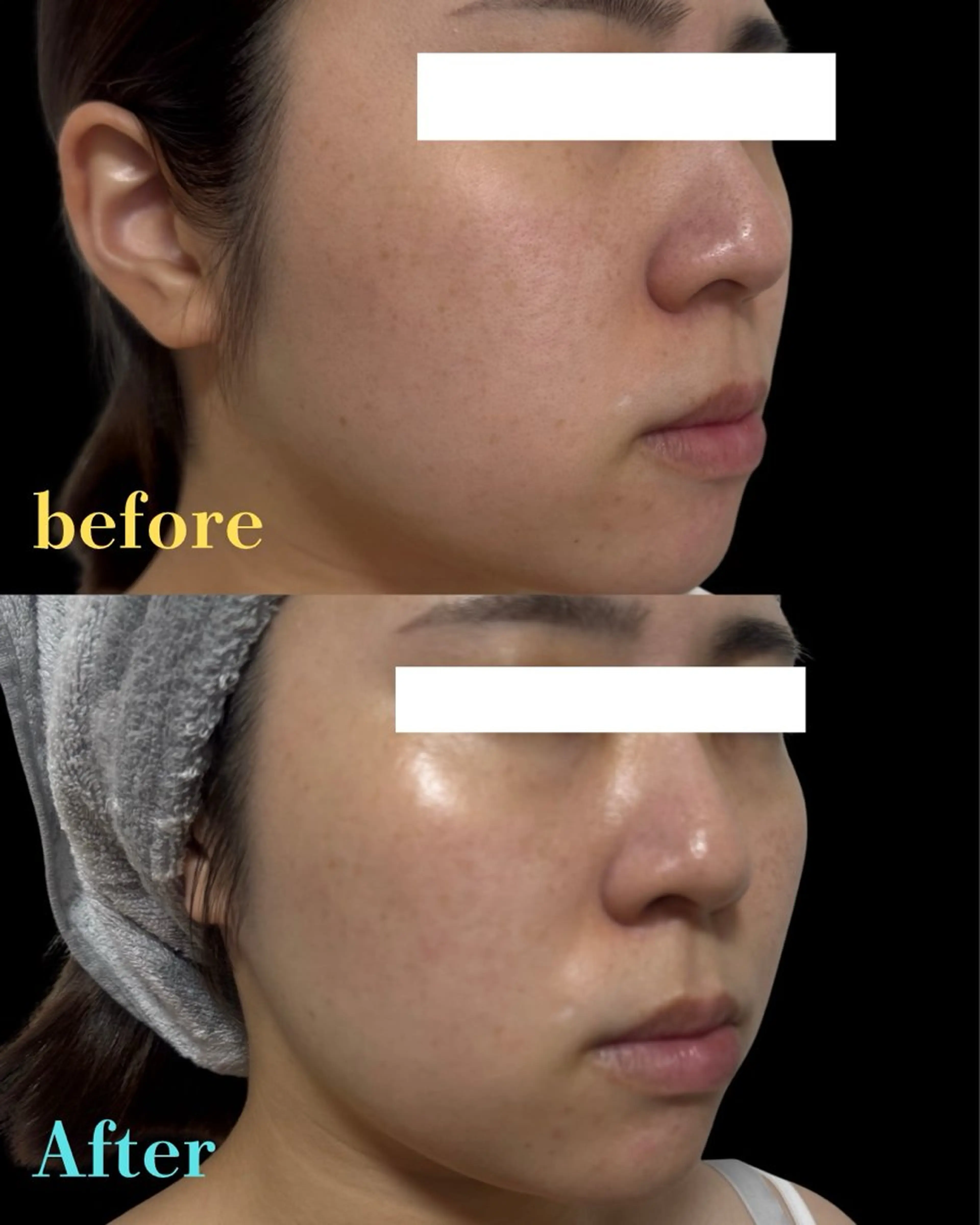 Noel所属・サロン Noelのエステ・リラクイメージ