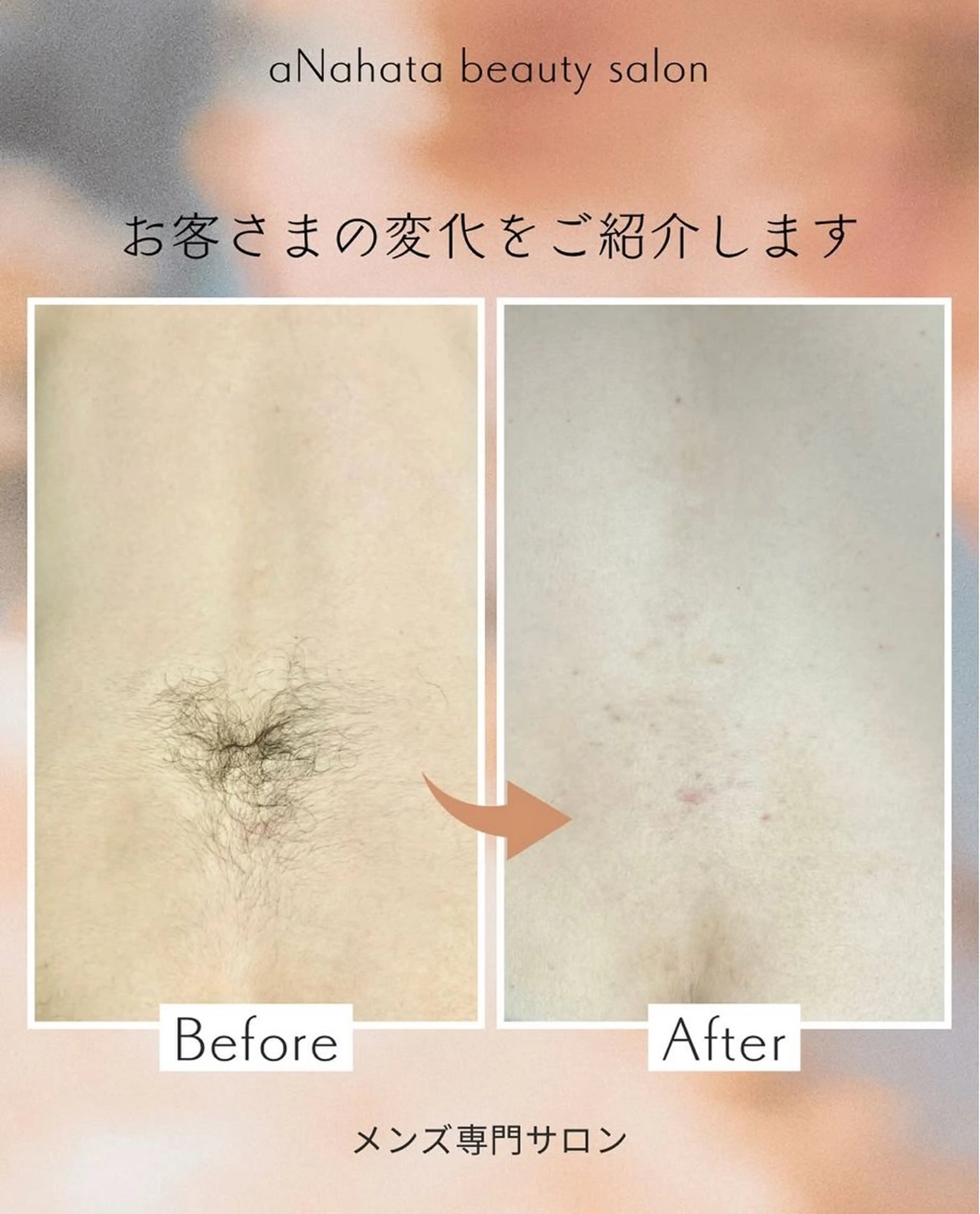メンズ 脱毛 aNahata beauty salon所属・田中 菜月のエステ・リラクイメージ