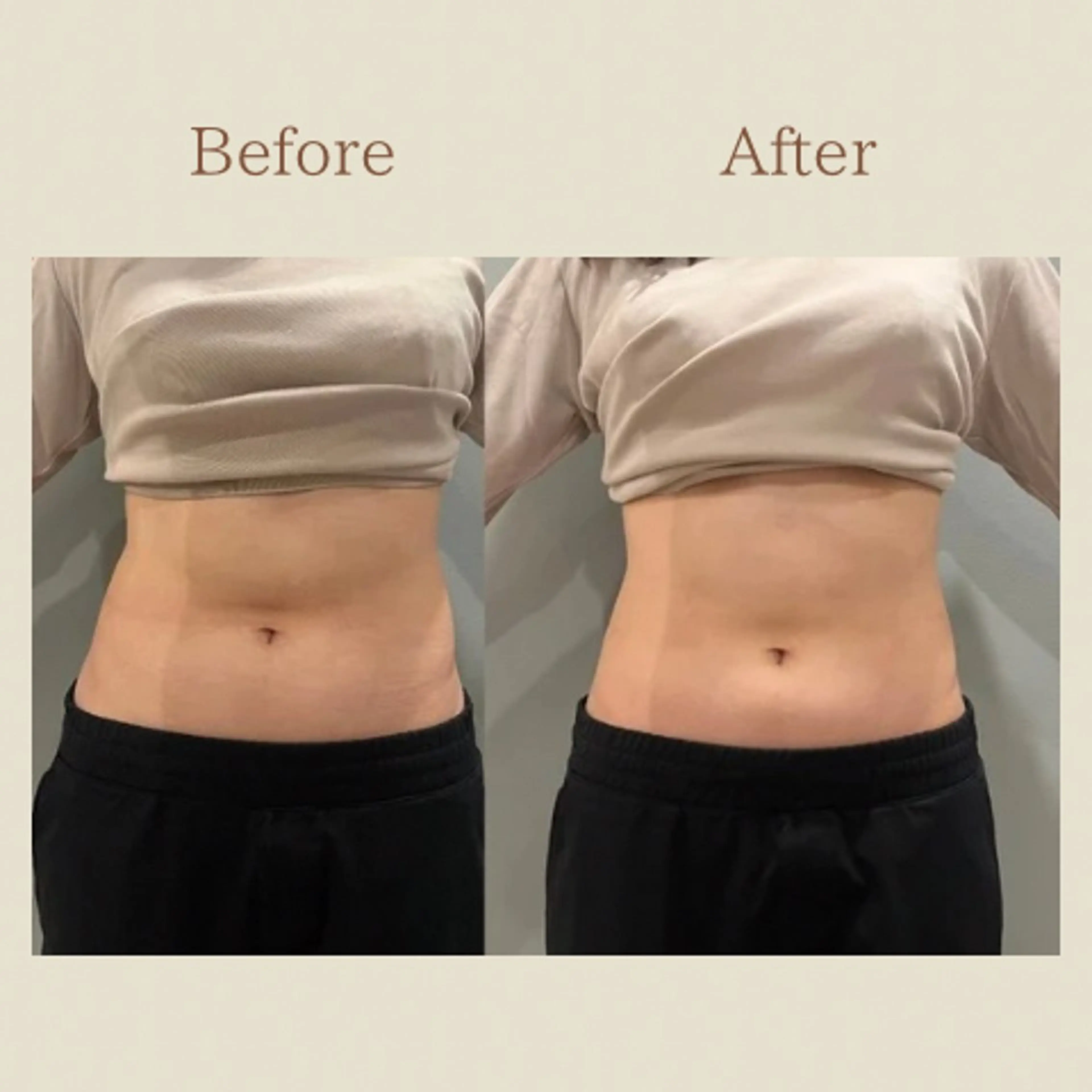 お腹痩せエステ Flat BELLY 恵比寿所属・【腸もみ/脂肪冷却】 お腹エステ/恵比寿のエステ・リラクイメージ