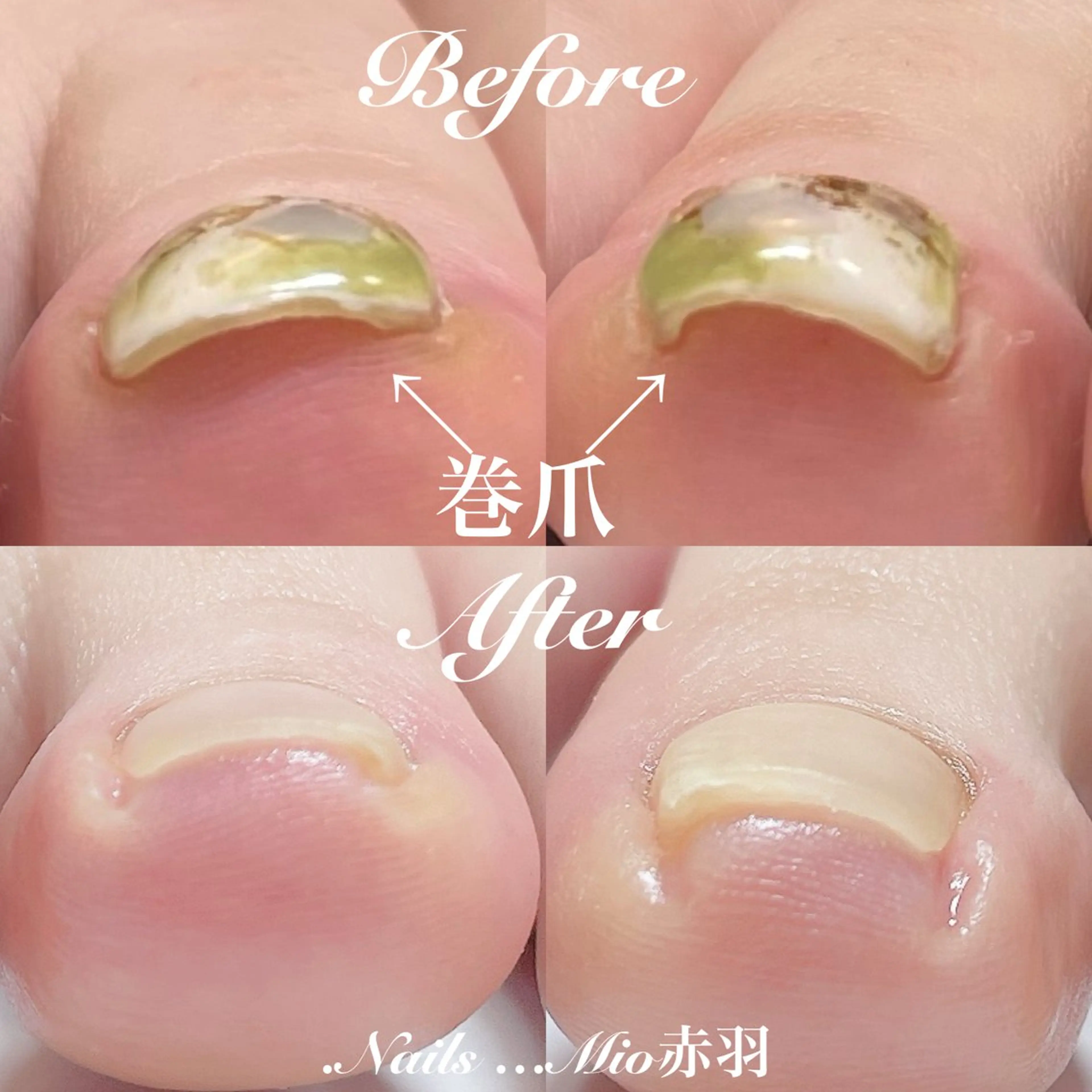 ネイル フットネイル ジェルネイル フットネイル .Nails Mio 赤羽西ネイルサロンのネイルデザイン