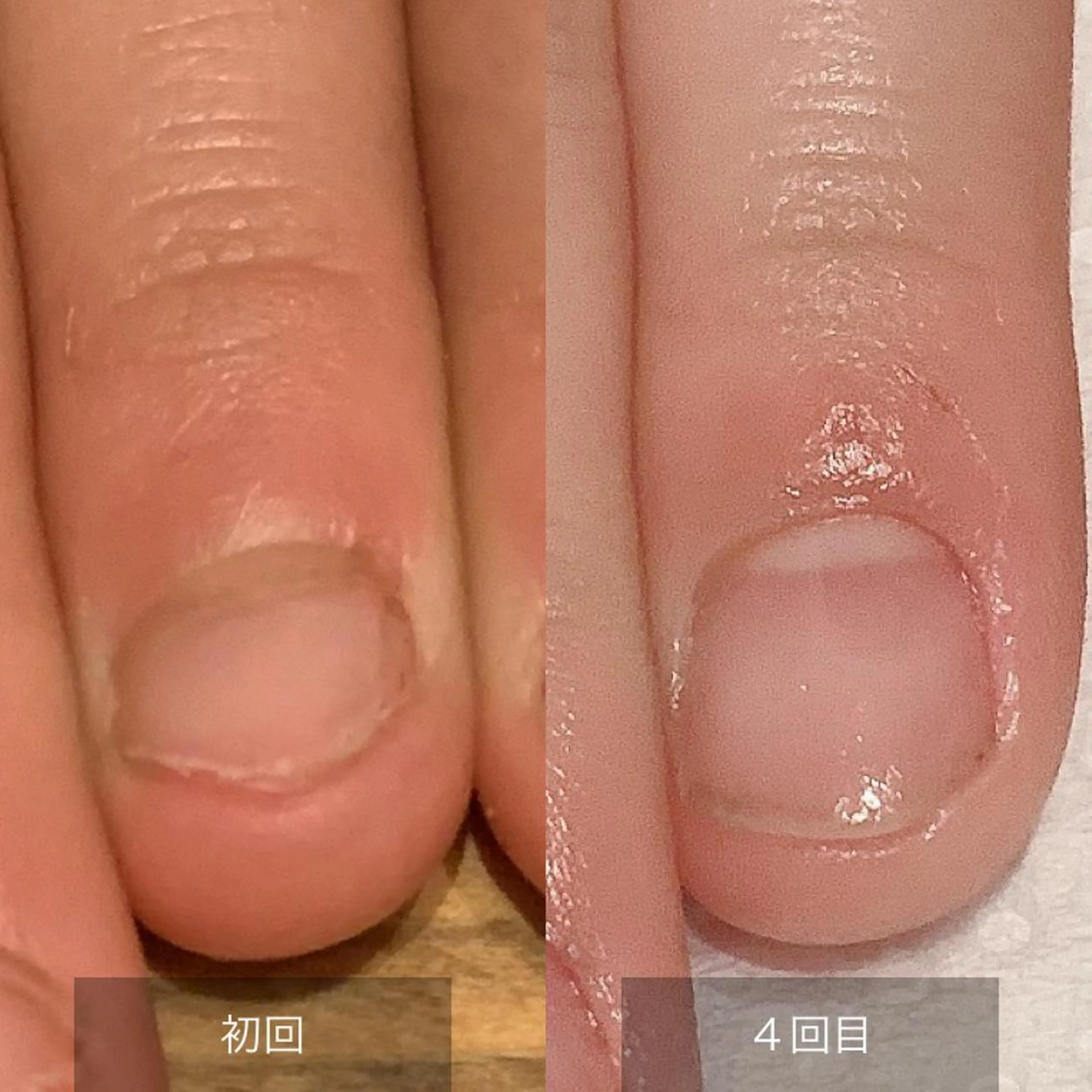 ネイル その他(ネイル) 木村 千晴のネイルデザイン