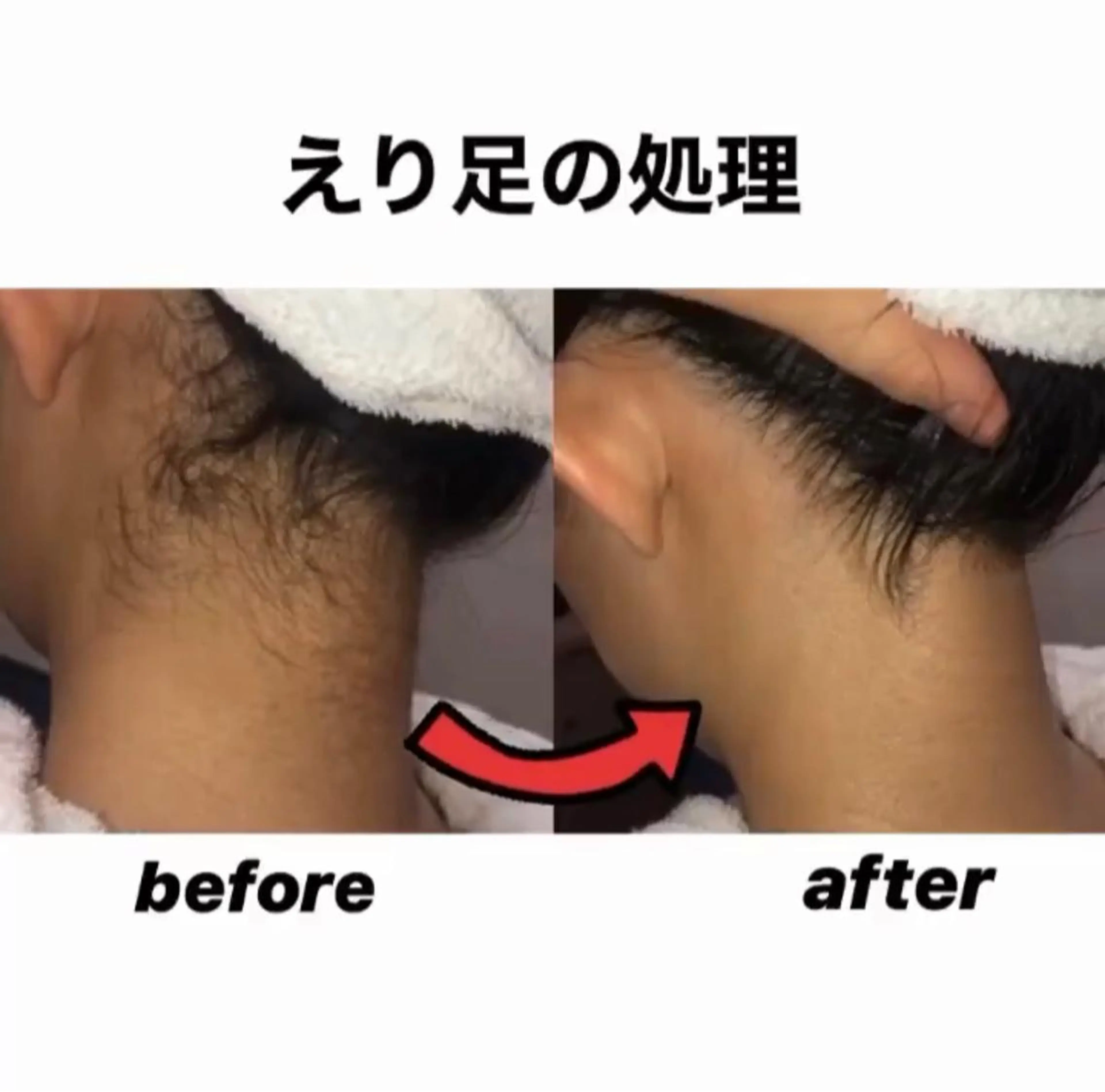 脱毛 銀座マツナガ新宿野村ビル店所属・女性理容師 佐藤優菜のヘアスタイル
