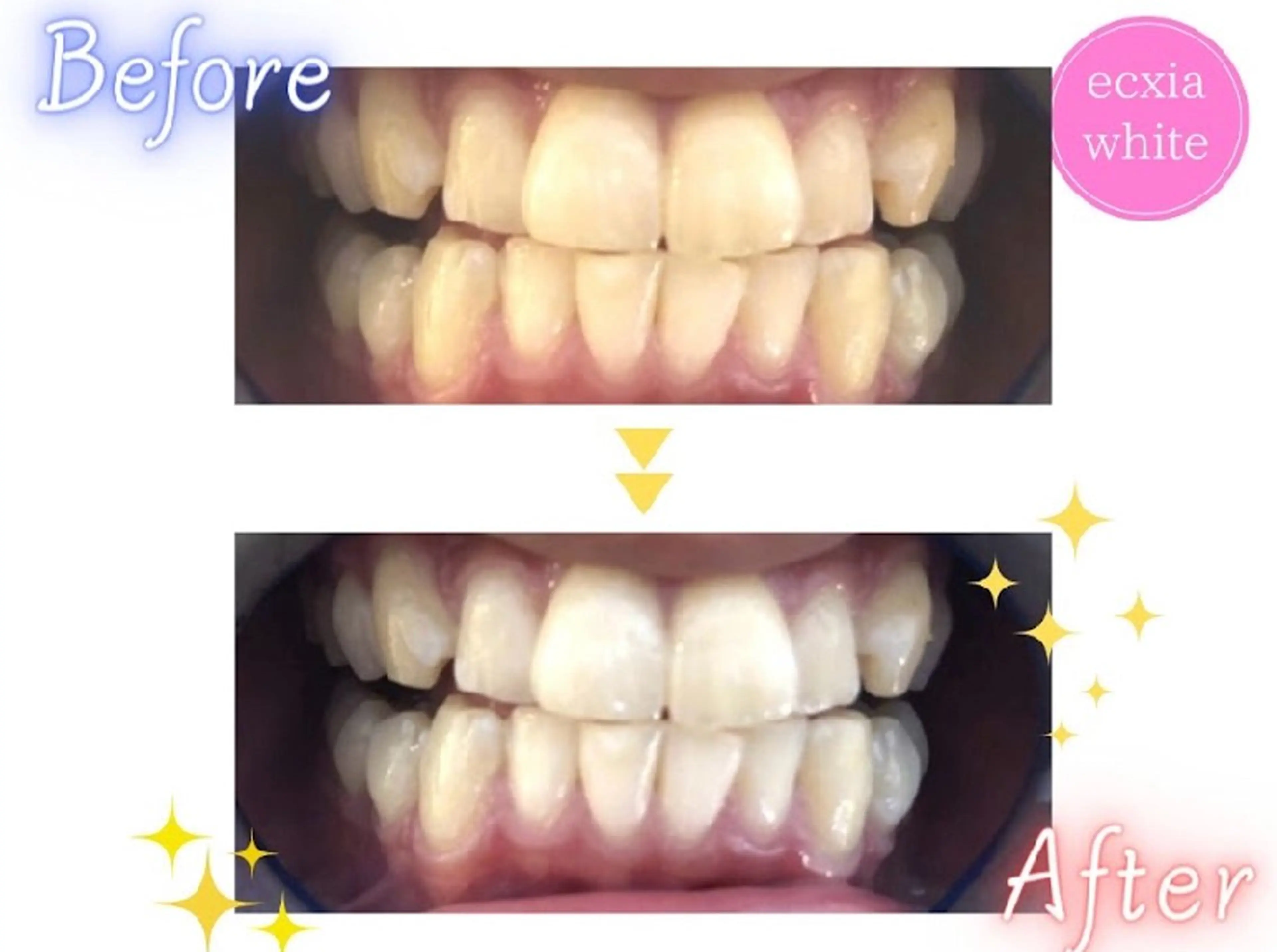 エクシアホワイトニング草津店所属・エクシア ホワイトニング草津店のその他イメージ