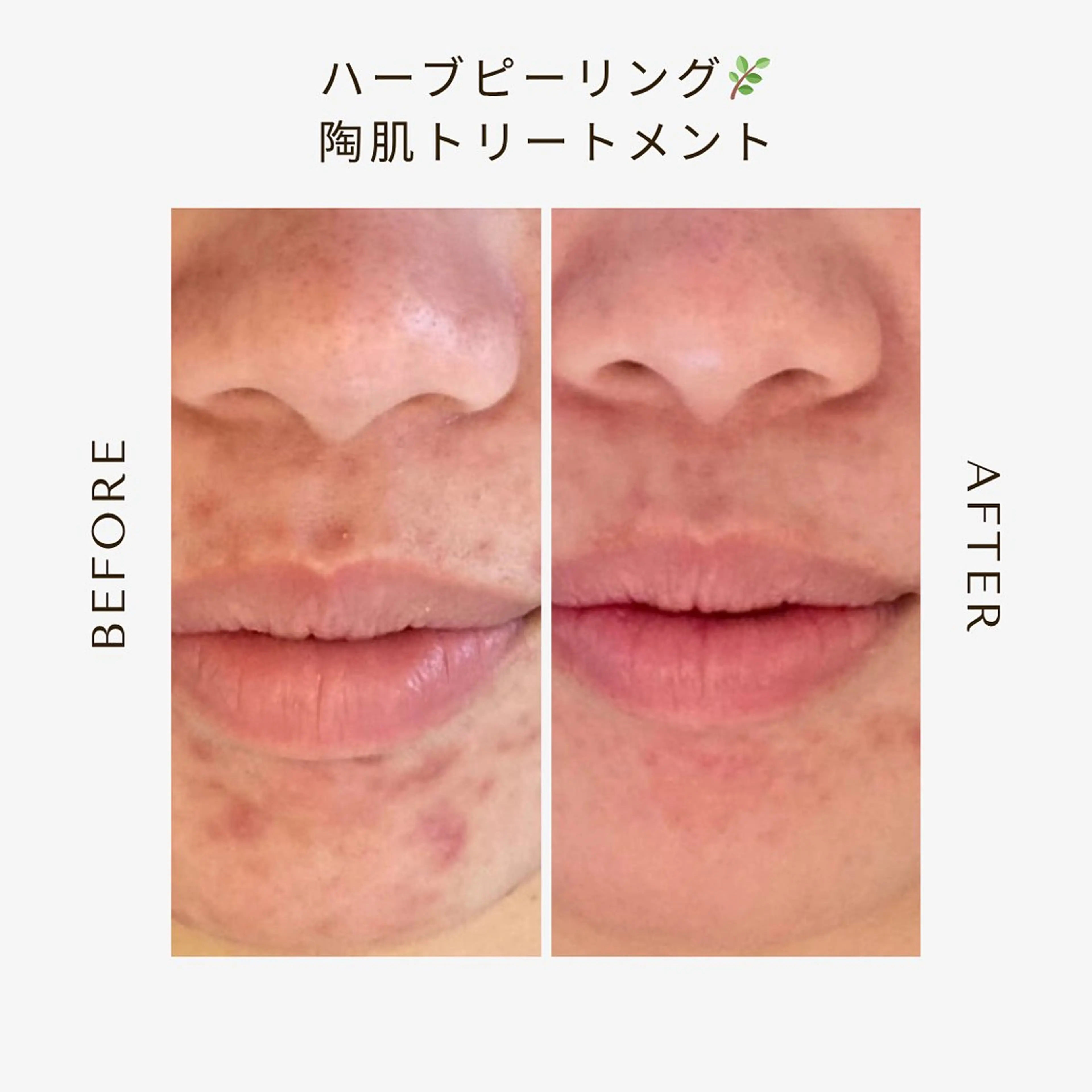 private beauty salon Lilby所属・リルビー 肌質改善・肌育サロンのエステ・リラクイメージ