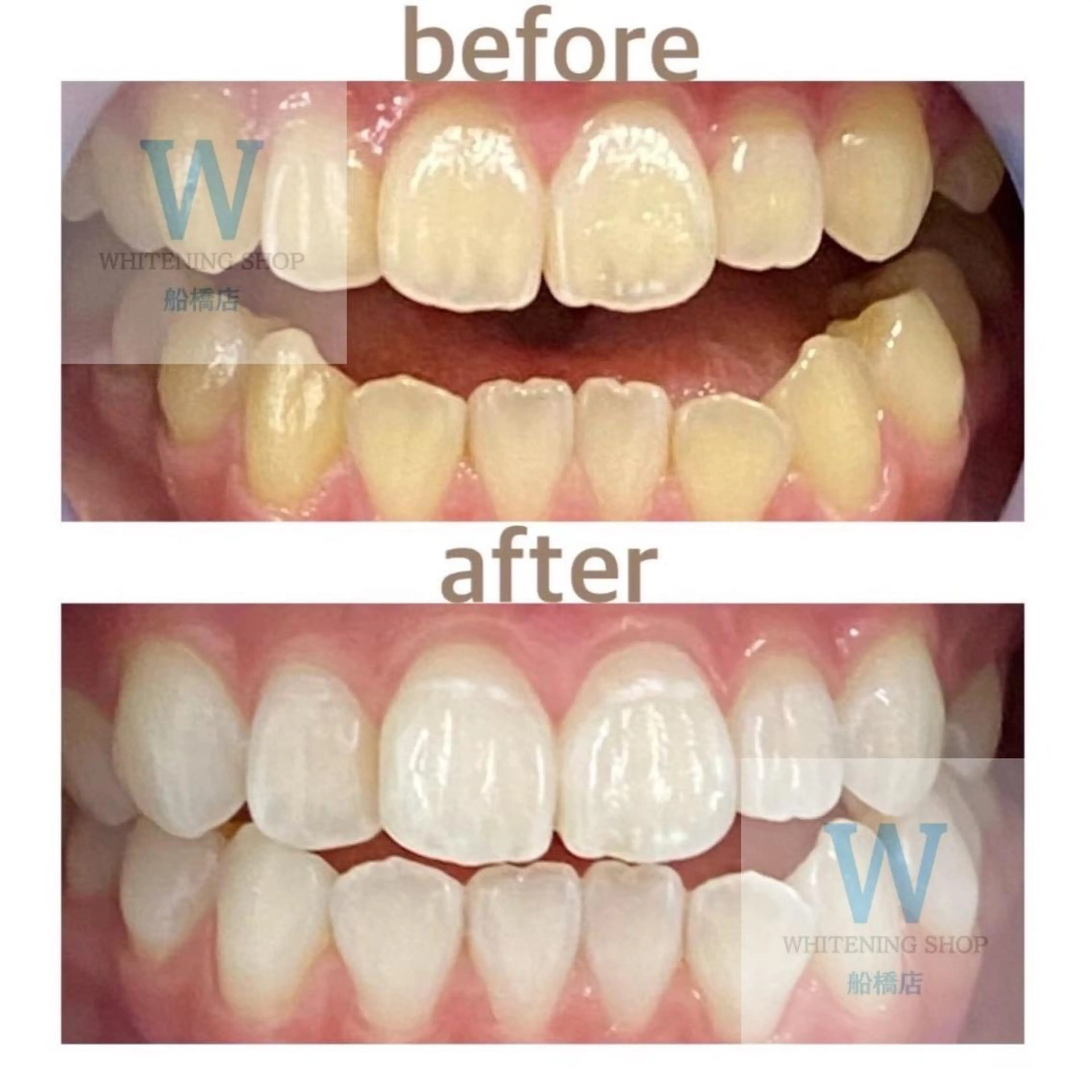 ホワイトニング ショップ船橋２号店のエステ・リラクイメージ