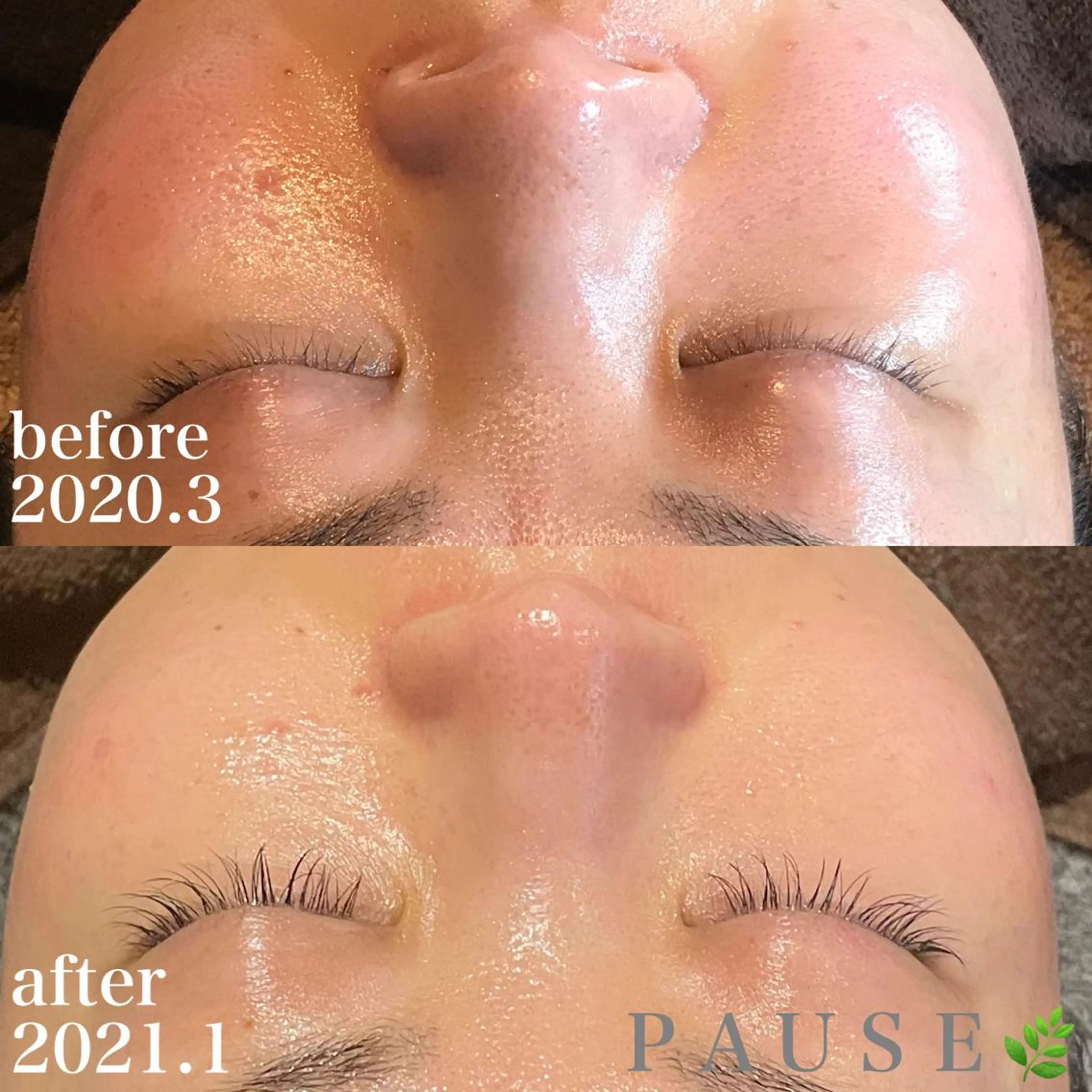 エステ 浜野 恵美のエステ・リラクイメージ