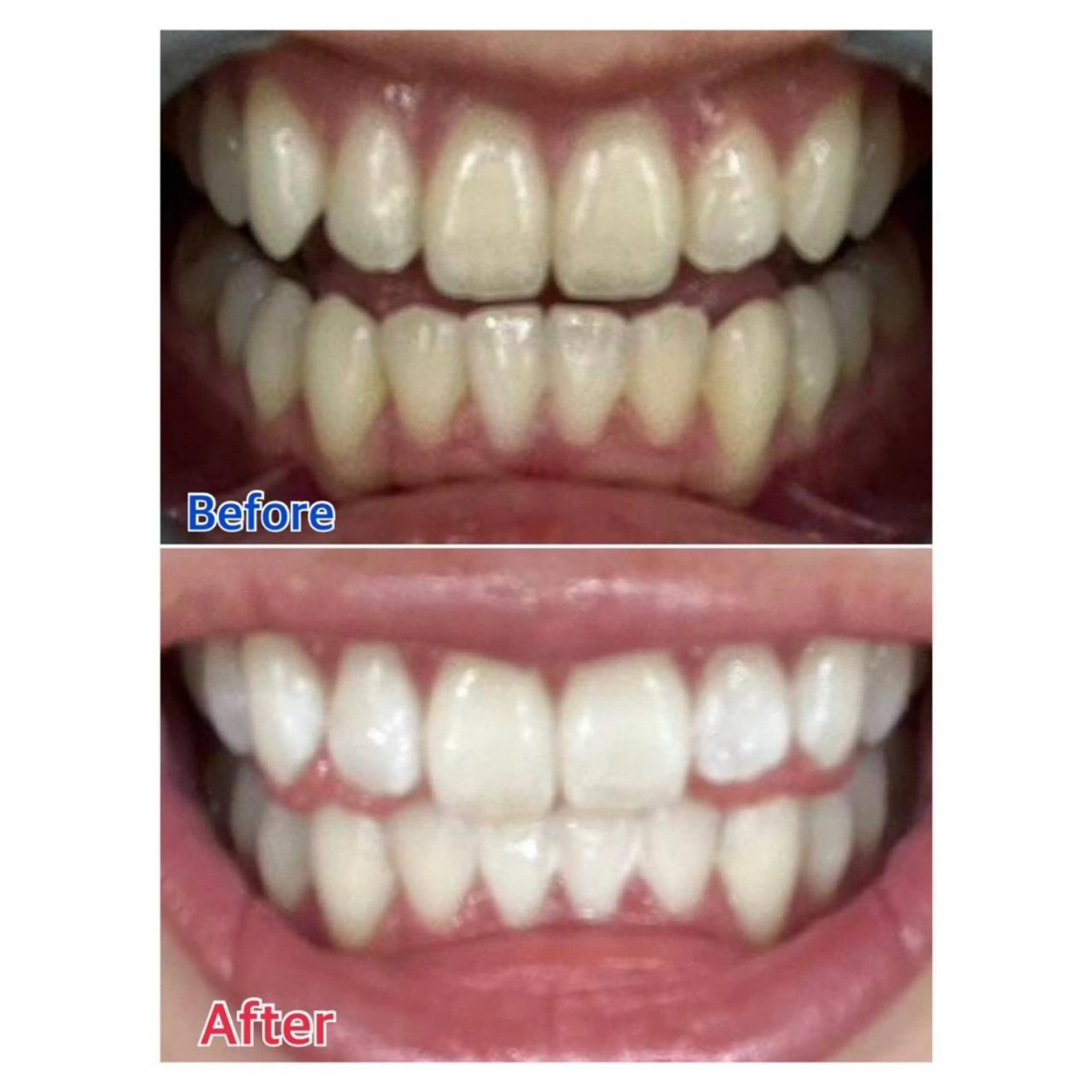 MBEAUTYSALON 千葉店・京成大久保所属・Melty 輝のその他イメージ