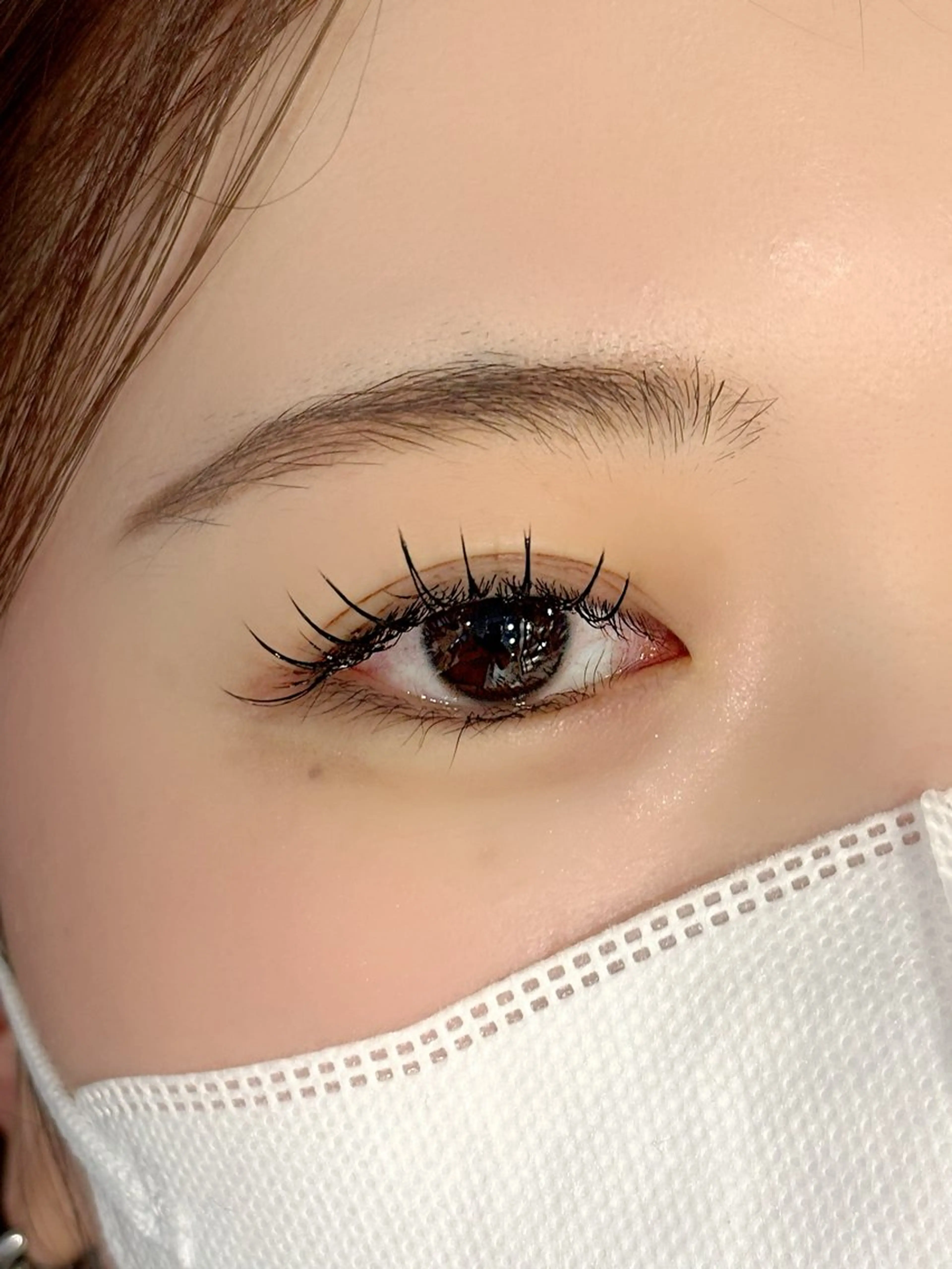 フラット100本の写真