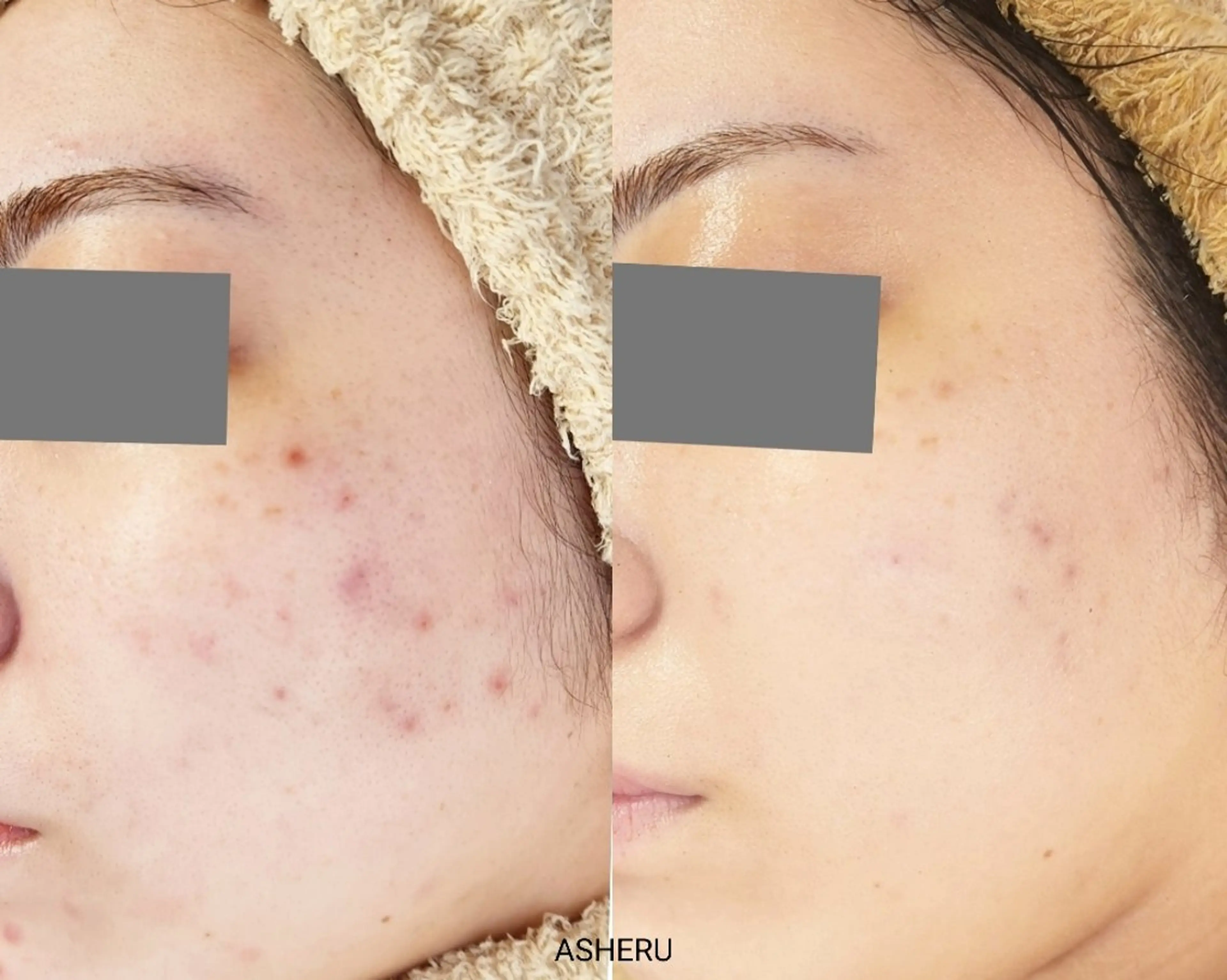 エステ ASHERU* Yuiのエステ・リラクイメージ