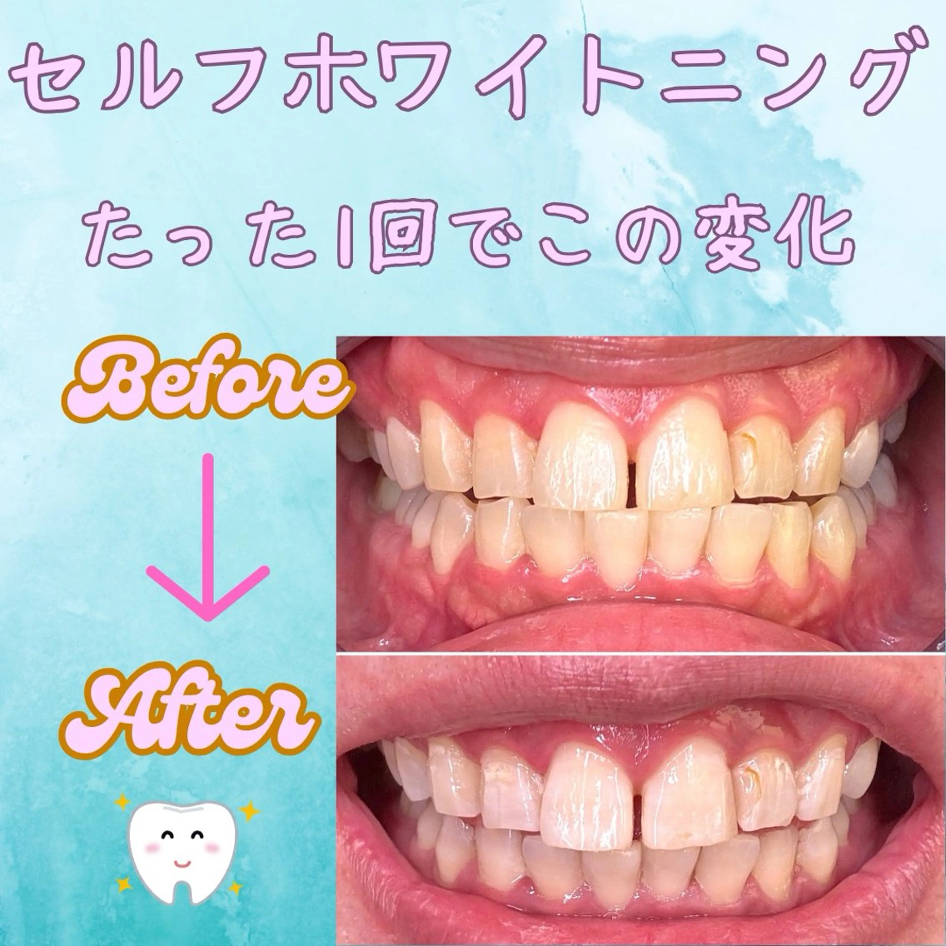 メンズ その他 soerute所属・オーラルケアサロン soeruteのその他イメージ