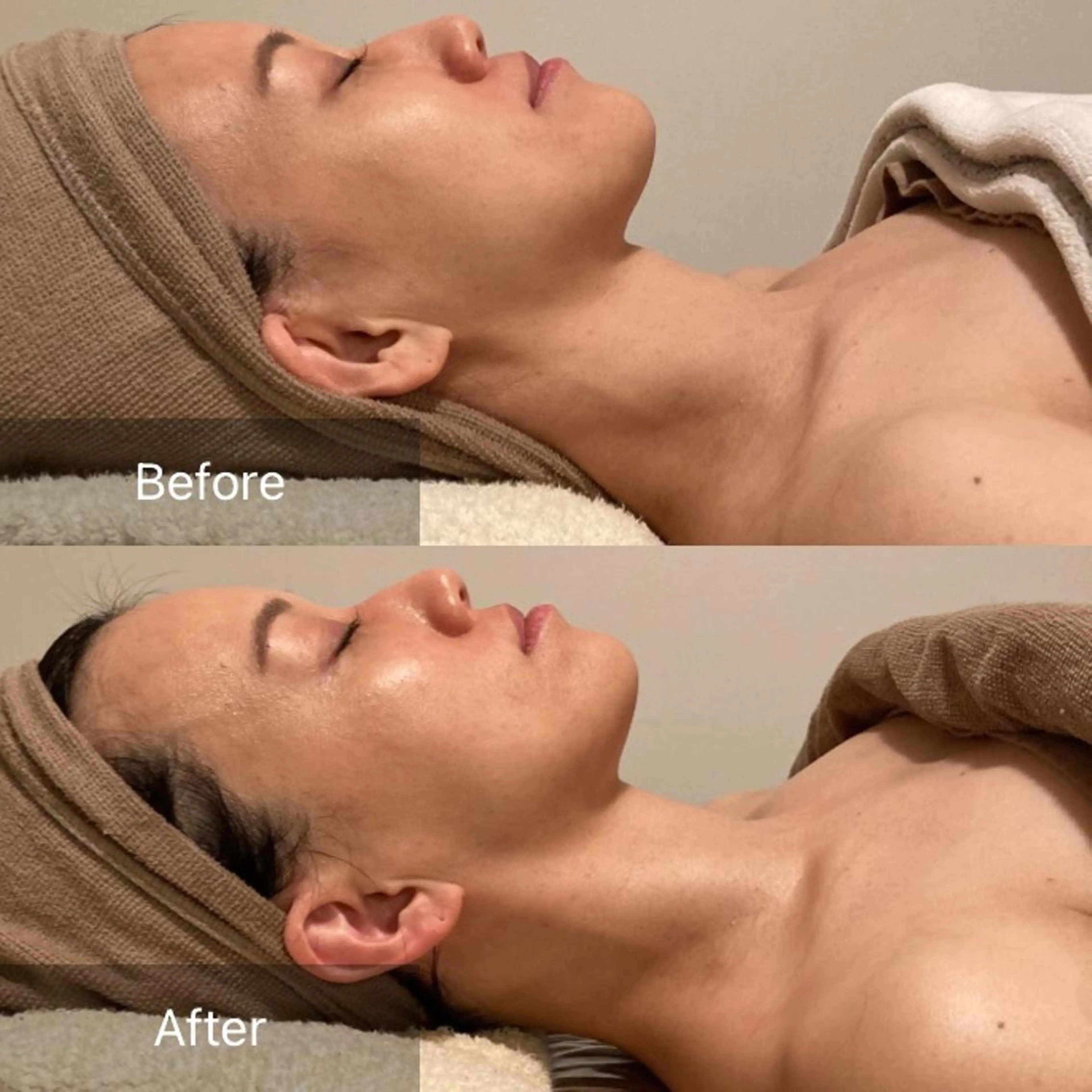 Ｂ&H所属・頭痛•肩こり専門/ 眉サロンB&H心斎橋のエステ・リラクイメージ