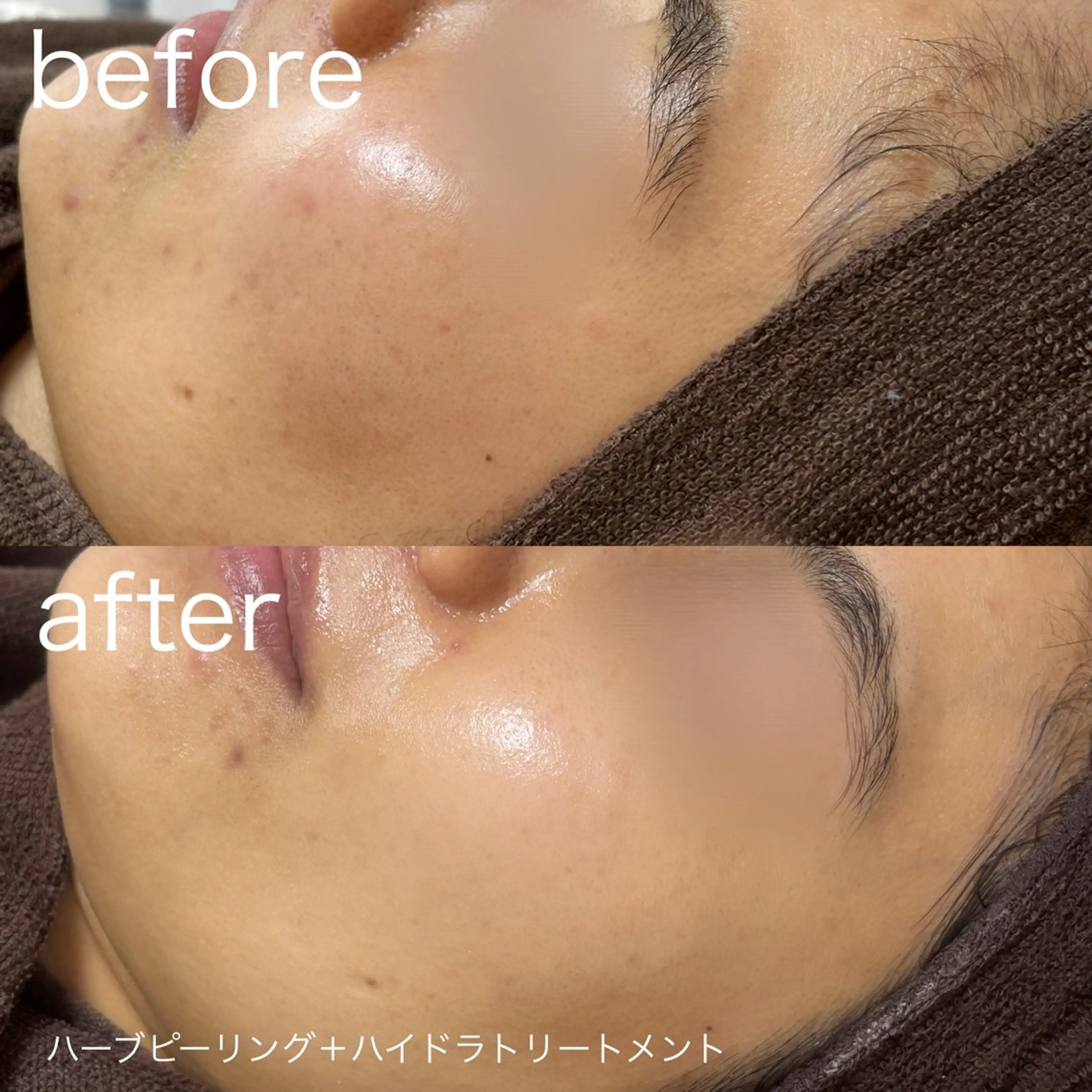 その他 lulularico Yuのエステ・リラクイメージ