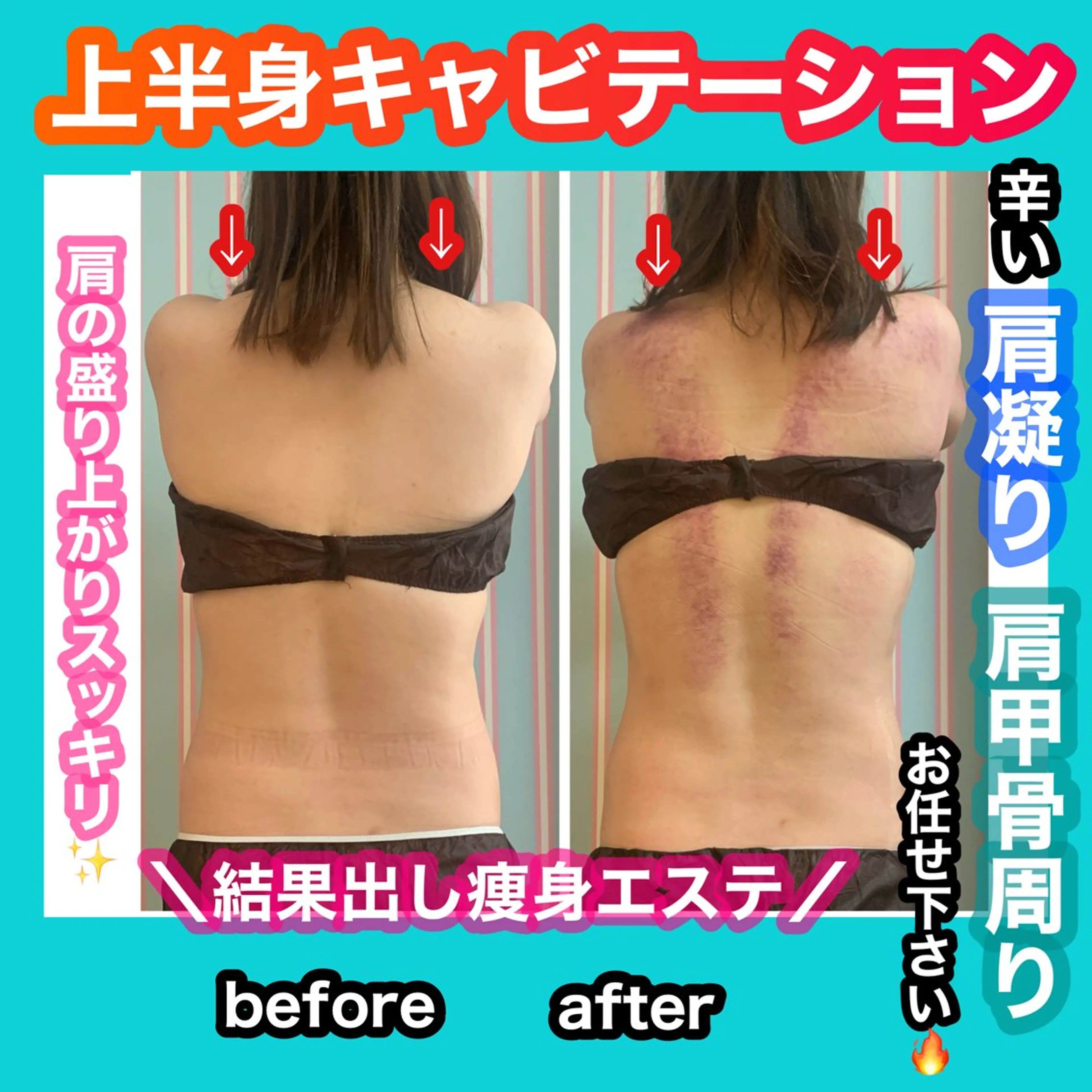 エステ リラク 痩身/脱毛/ネイル HARUKAのエステ・リラクイメージ